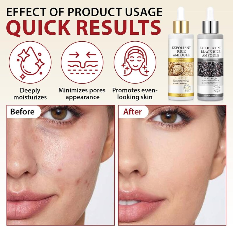 Peel Shot Glow Rice Ampoule Duo - Black & White Rice Exfoliant for All Skin Types | Moisturizing Pore Minimizer & Deep Hydration
