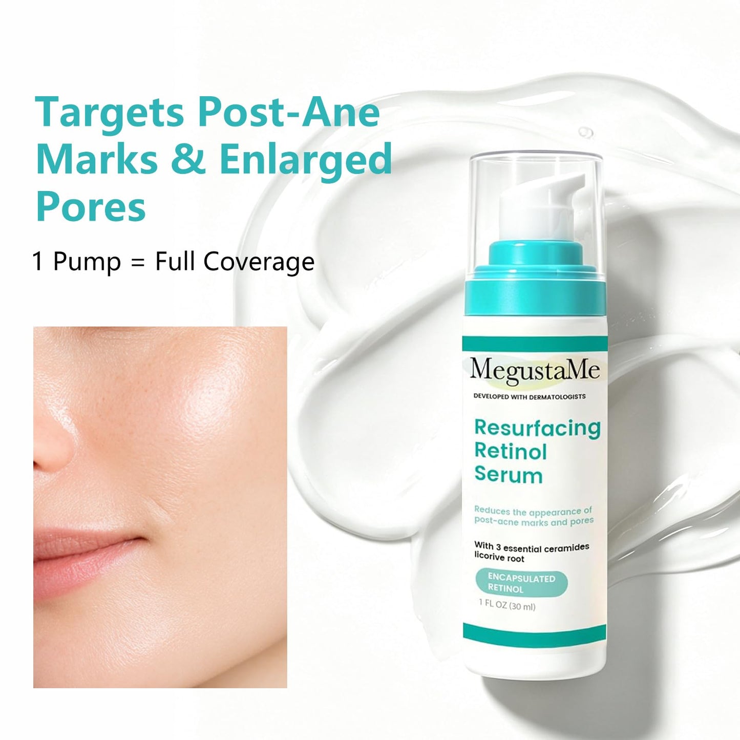 MegustaMe Resurfacing Retinol Serum for Acne Scars & Pores, 30ml. Encapsulated Retinol for Sensitive Skin, Gentle Anti-Aging with Less Irritation. Dermatologist-Developed.