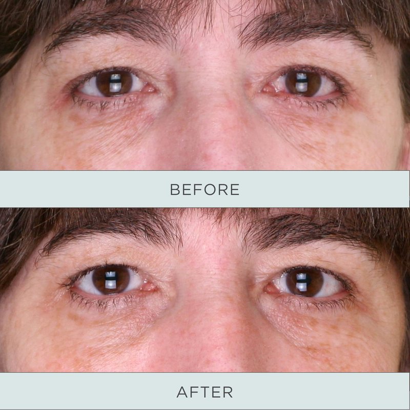 PÜR MINERALS Tone Up Niacinamide Firming Eye Serum for Women