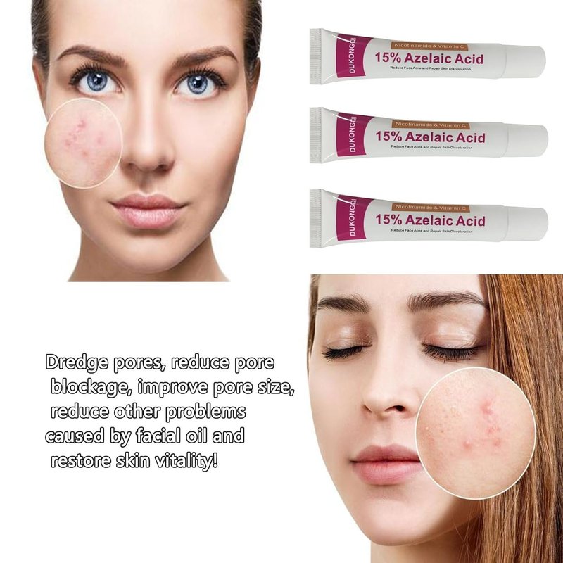 Azelaic Acid Serum - Balance Skin Tone & Cleanse Pores | Relieve Acne, Blackheads & Redness - 20g (1 PCS)
