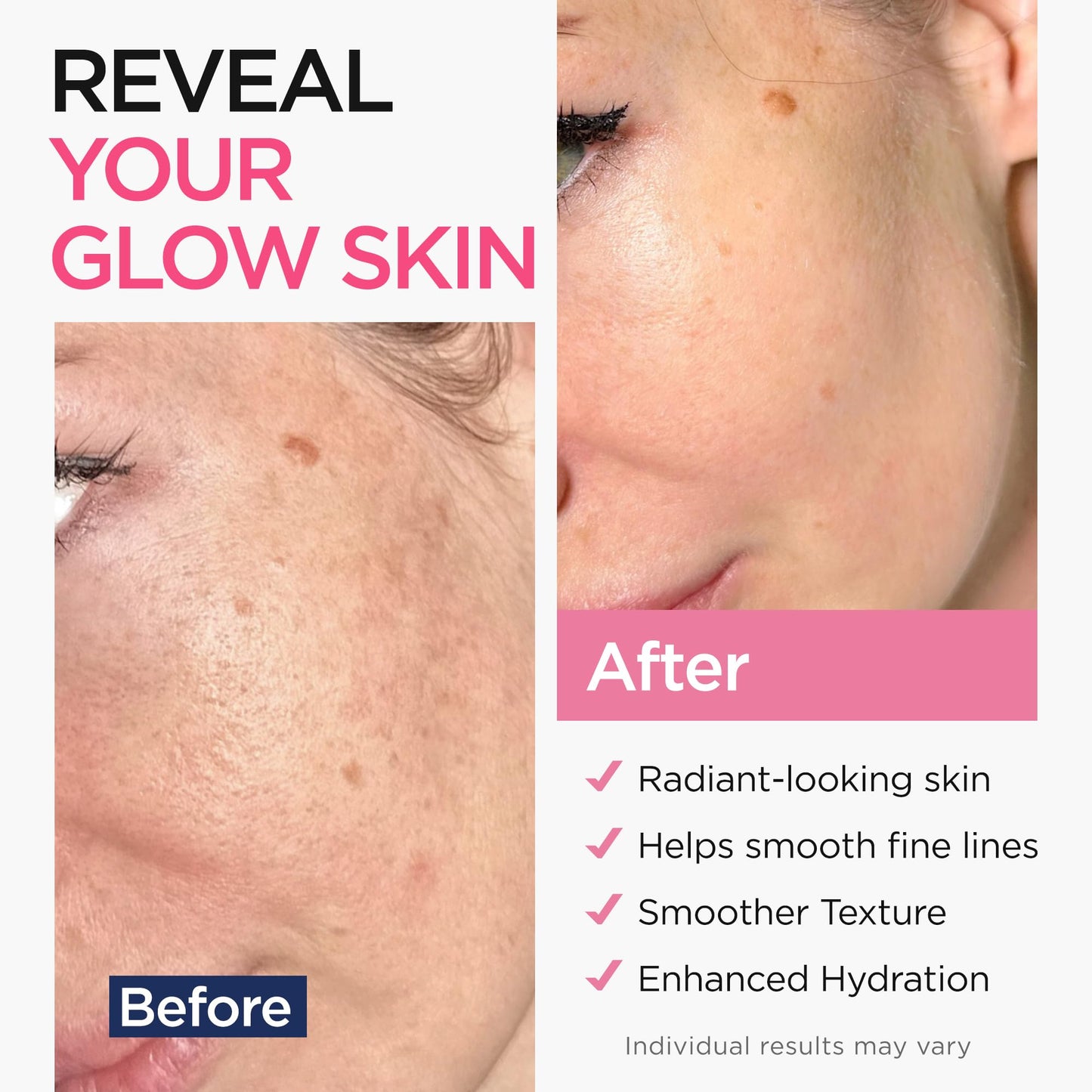 Ember Cloud Retinol Serum for Face with Hyaluronic Acid & Vit E 1 Oz