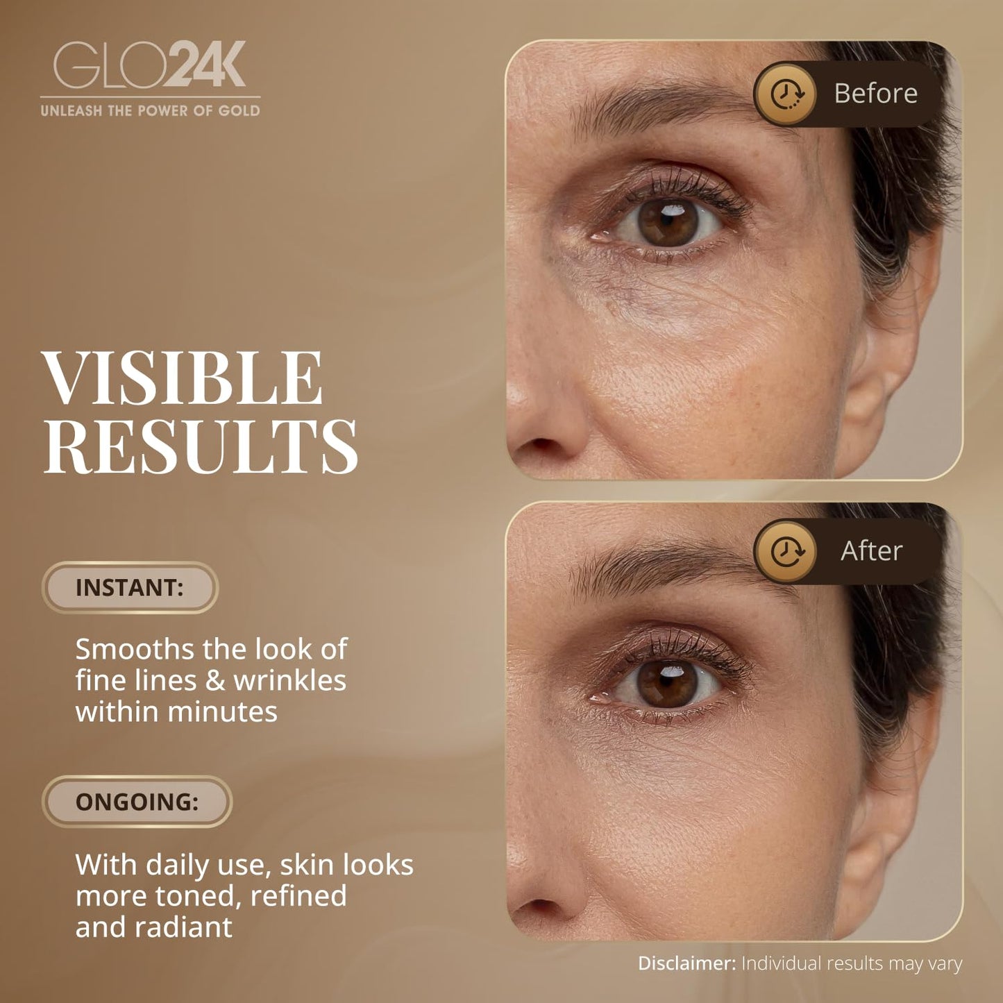 GLO24K Instant Facelift Cream with 24k Gold, Hyaluronic Acid, Peptides, and Vitamins A,C,E - Non-Invasive Alternative to Injections for Fast Results