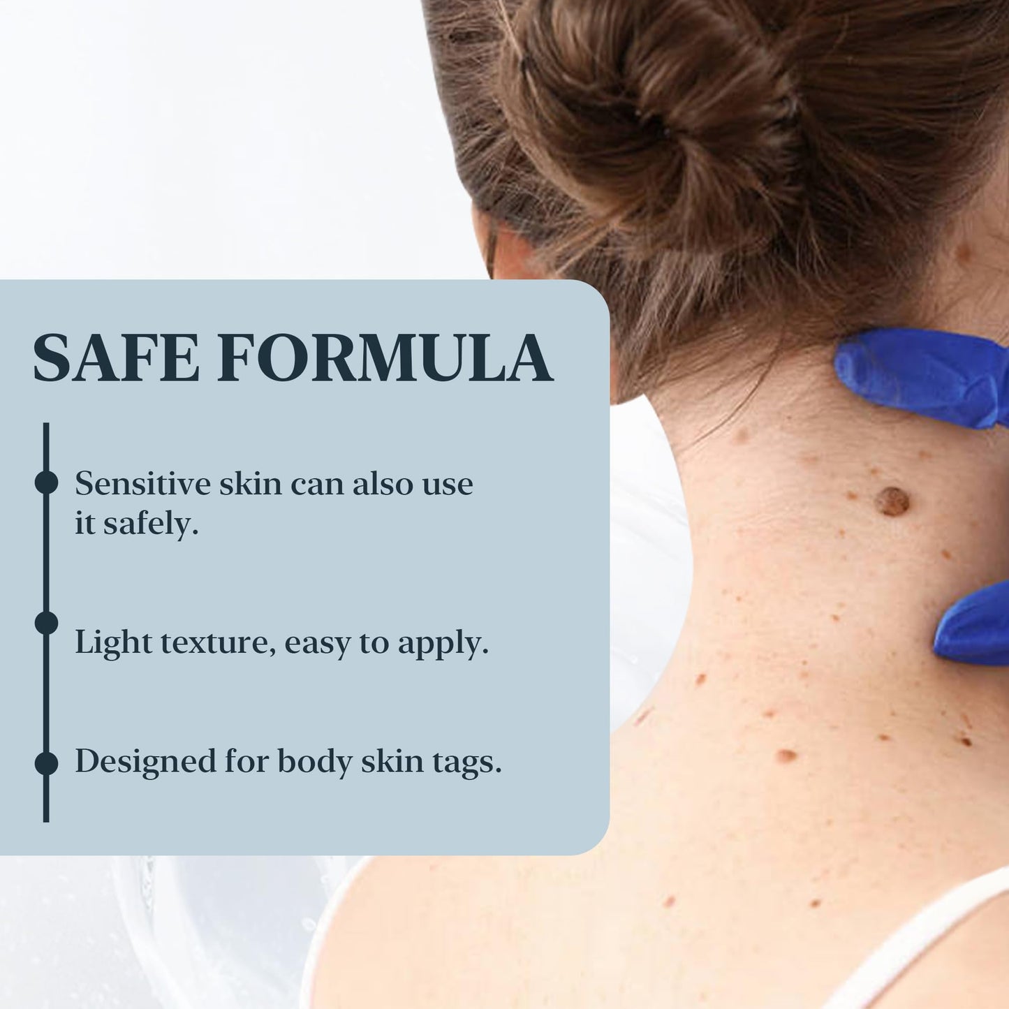 Musiyuan Facial and body mole and skin growth removal serum – fast-acting, precise dropper design effectively removes various warts (30ml)