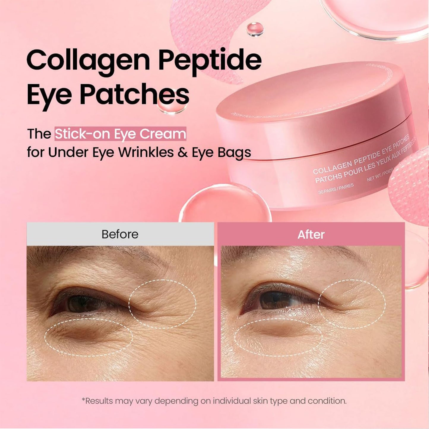 Under Eye Patches Masks-60 PCs for Dark Circles, Puffy Eyes, Fine Lines, Wrinkles, Eye Bags Treatment with Collagen & Hyaluronic Acid - Day & Night Skin Treatment Pads,Moisturizing and Hydrating