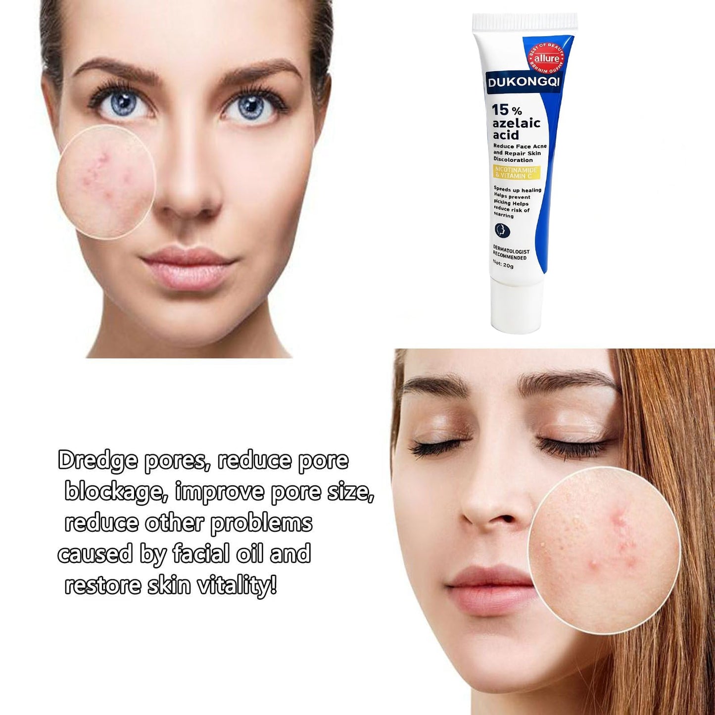 Azelaic Acid for Face Balance Skin Tone & Cleanse Pores, Azelaic Acid Serum Acido Azelaico-Relieve Acne, Blackhead & Redness,Premium Skin Care, 20g (1 PCS)