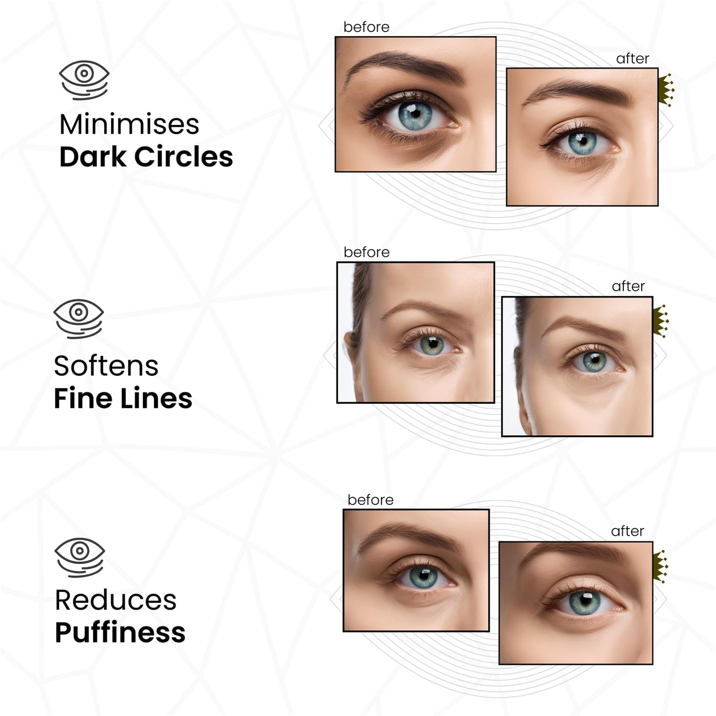 REVITALE Pure Vegan Under Eye Patches, Helps Reduce Puffy Eyes & Dark Circles, Revitalise Dull Eye Masks - Nourishes, Renews, Soothes (Packets - 10 Pair)