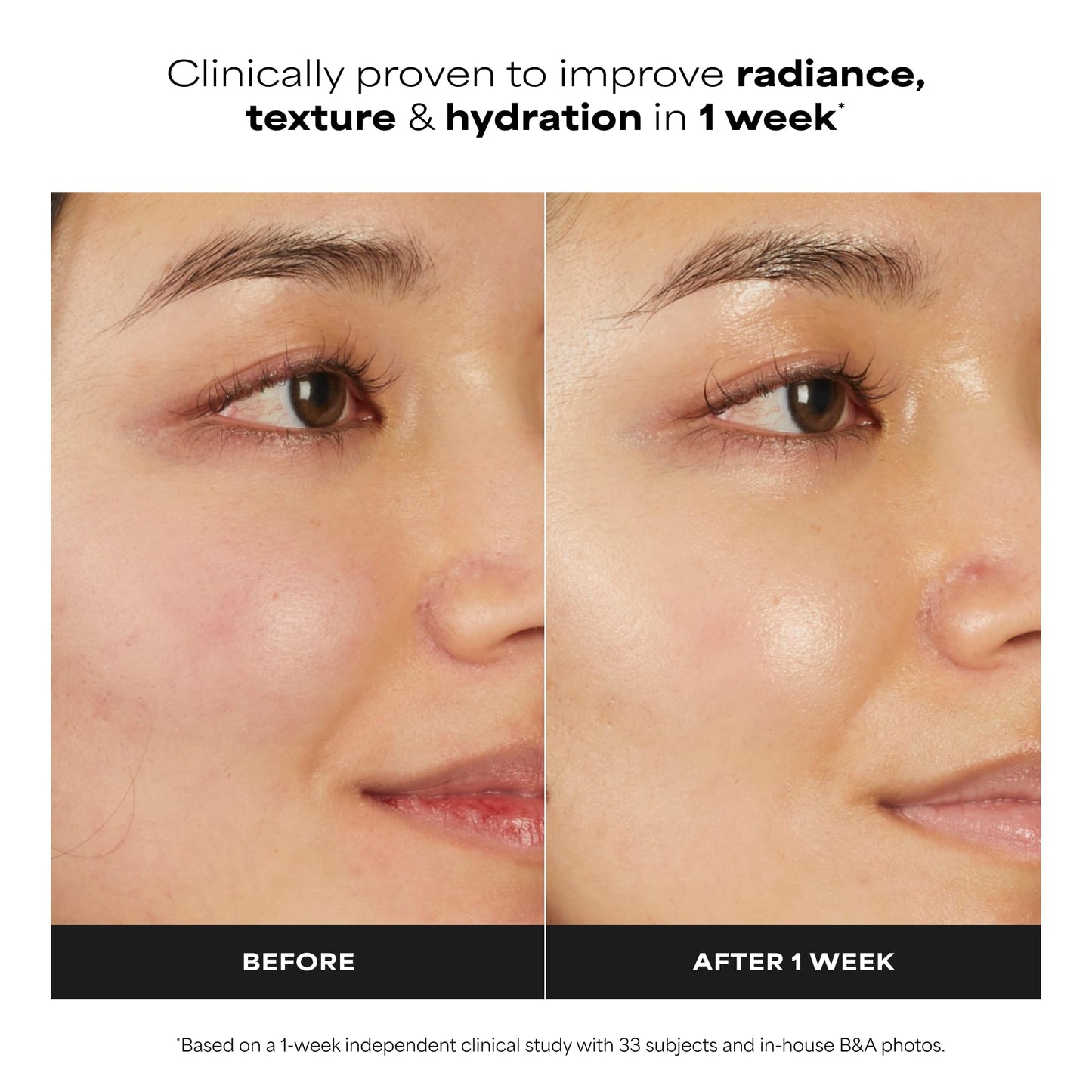 Paula's Choice 7% Ectoin + Hyaluronic Acid Hydrating Face Serum, 0.67 Fl Oz