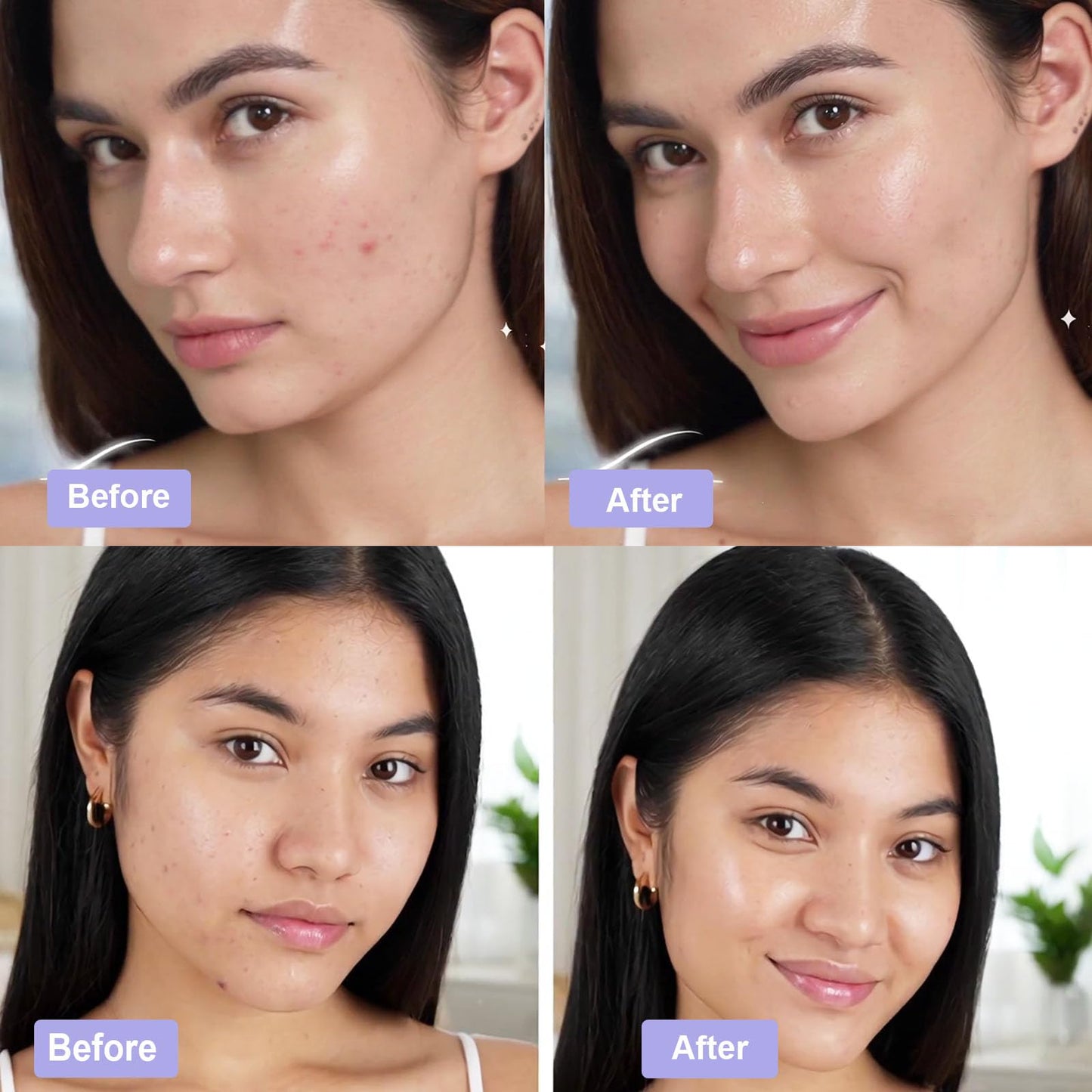 Madecassoside Toner Pads, Mild Exfoliating Pads, Calming Blemish Face Pad -Centella, Niacinamide, BHA Salicylic Acid for Soothe, Uneven Skin Tone, Dark Spots, Skincare 125 Pad Mothers Day Gifts