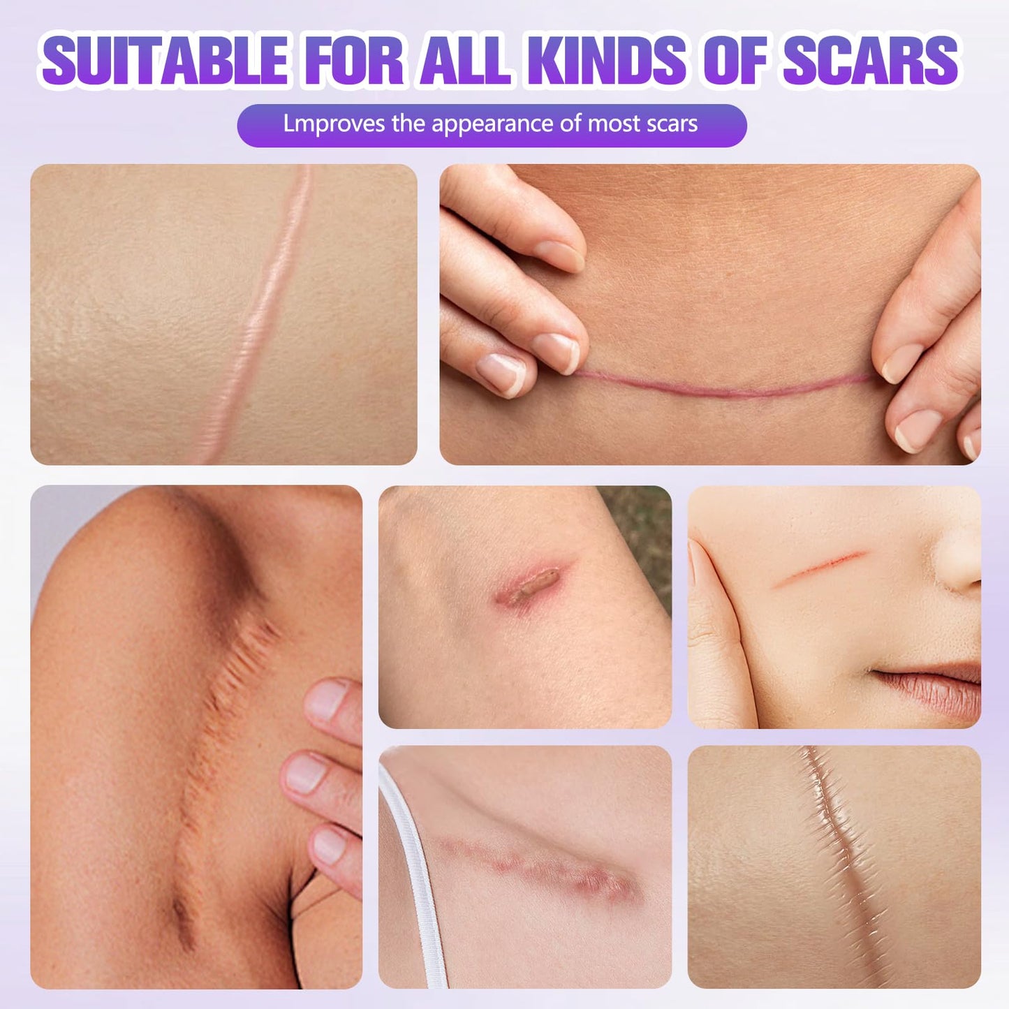 Collagen Tape, Collagen Sheets for Scars & Wrinkle, Silicone Scar Removal Strips for Various Different Scars and Wrinkles, for Surgeries Burn Acne Wounds Recovery