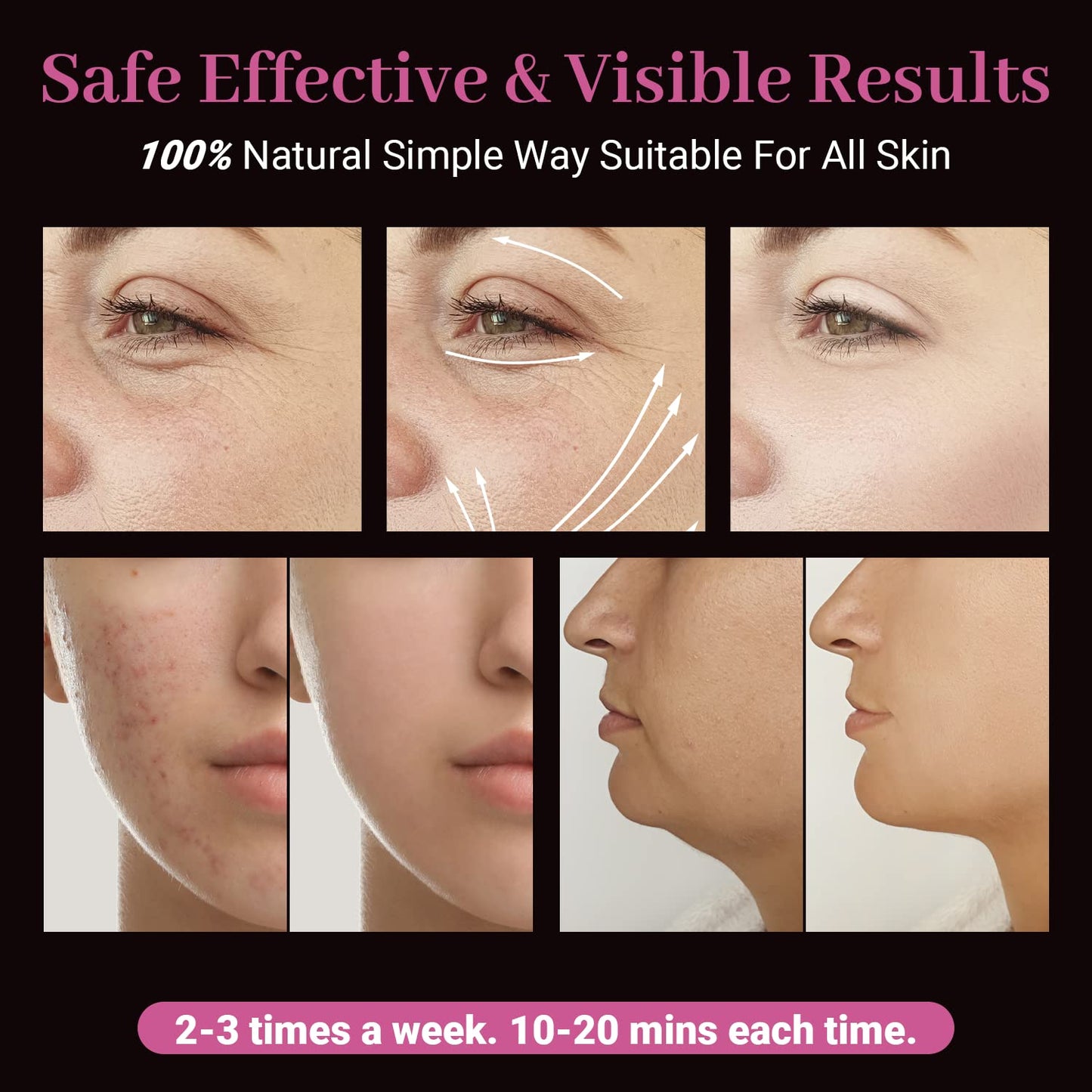 High Frequency Facial Wand - UUPAS Portable Handheld High Frequency