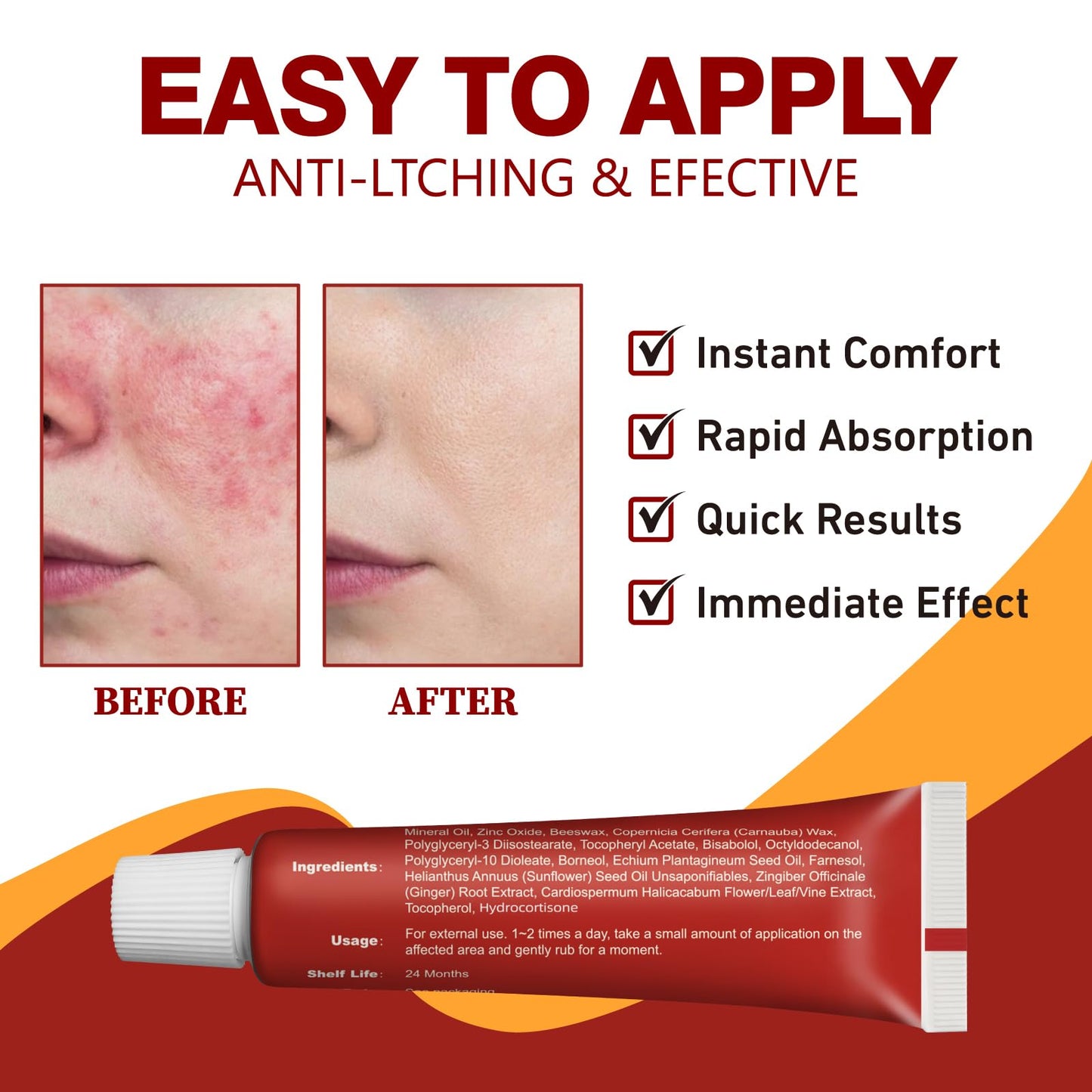 Seacall Hydrocortisone Cream - OTC Anti-Itch Relief for Eczema, Dermatitis & Skin Irritations | Maximum Strength Topical Treatment