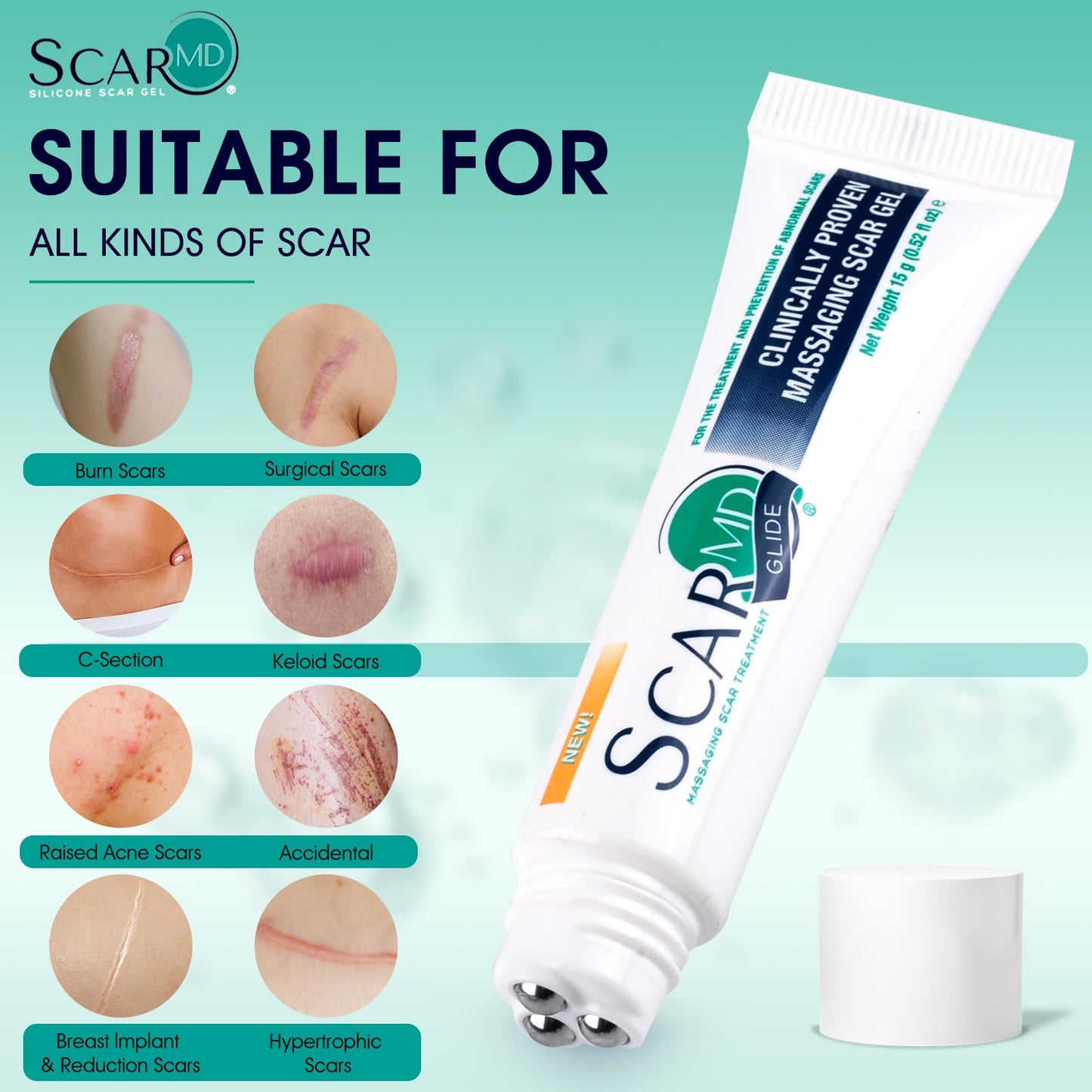 ScarMD Silicone Scar Gel Roll-On, 100% Pure Scar Cream, Advanced Scar Cream for Surgical Scars, Keloids & Stretch Marks | Clinically Proven Treatment for Old & New Scars