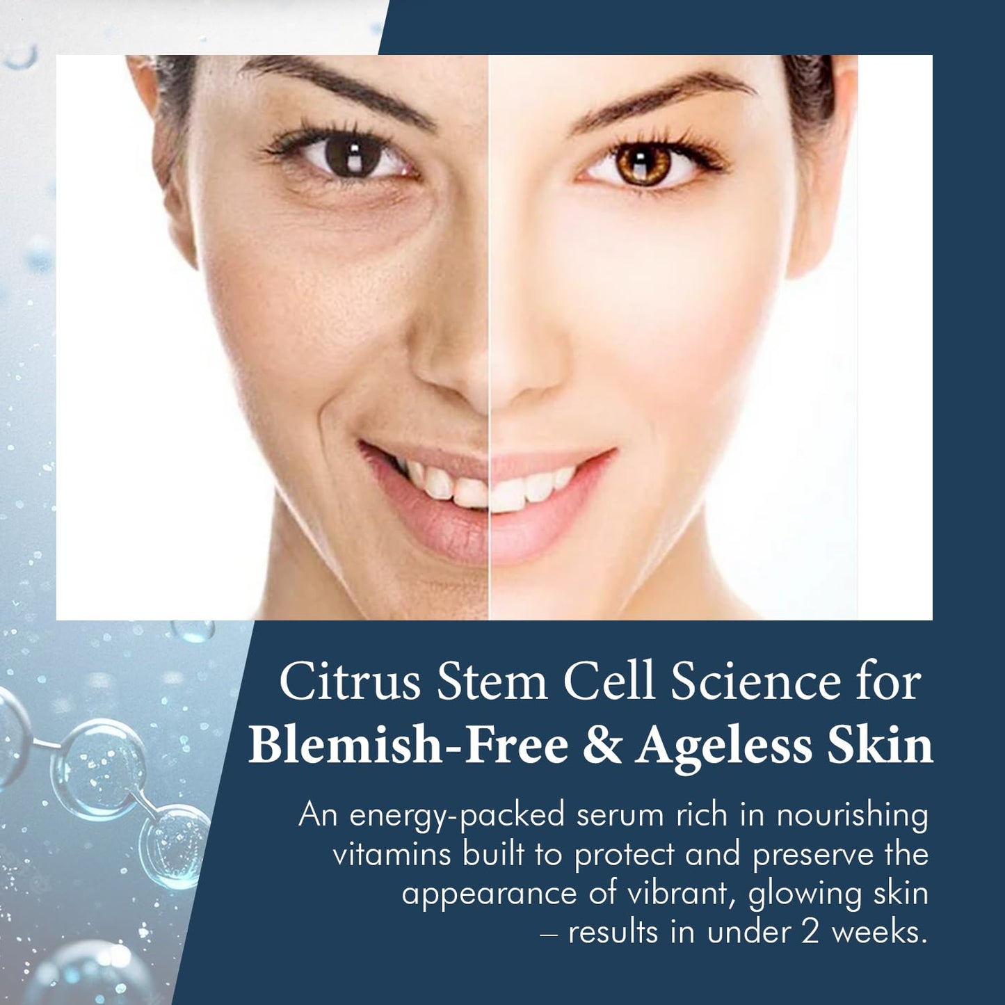 Delfogo Rx Vitamin C Stem Cell Serum for Face - Brightening Anti Aging Face Serum | Hydrating, Firming Skin Care with Hyaluronic Acid, All Skin Types for Men Women