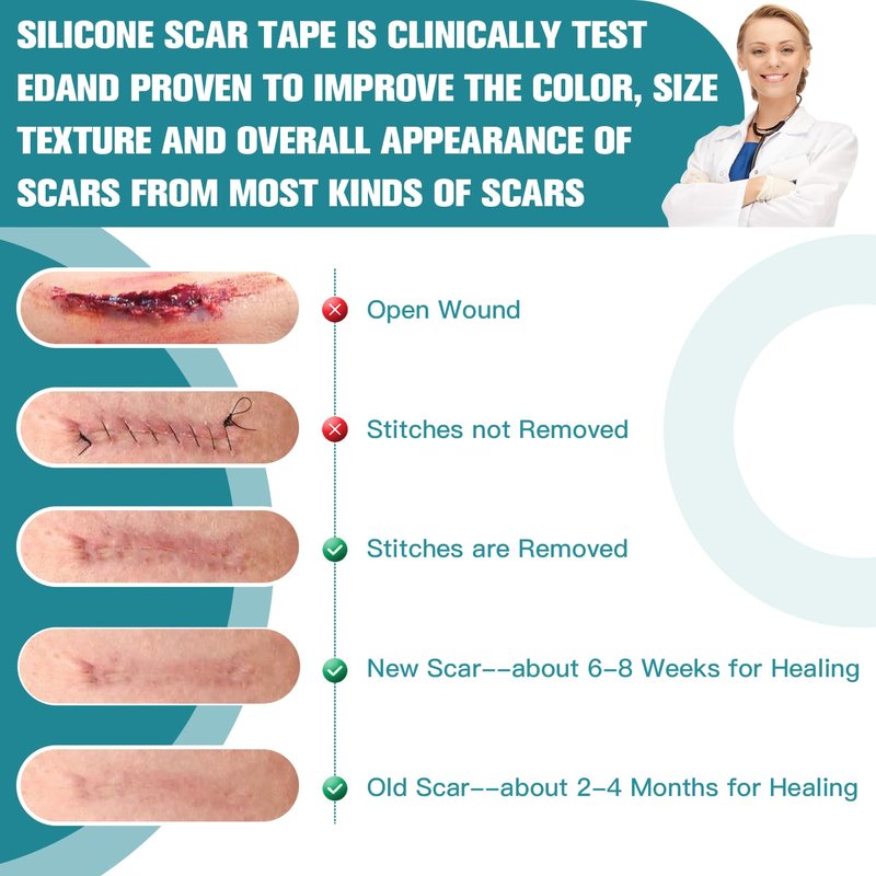 Silicone Scar Sheets - Ultra-Thin Scar Removal Tape for Surgical Scars | 1.6” x 120" Roll