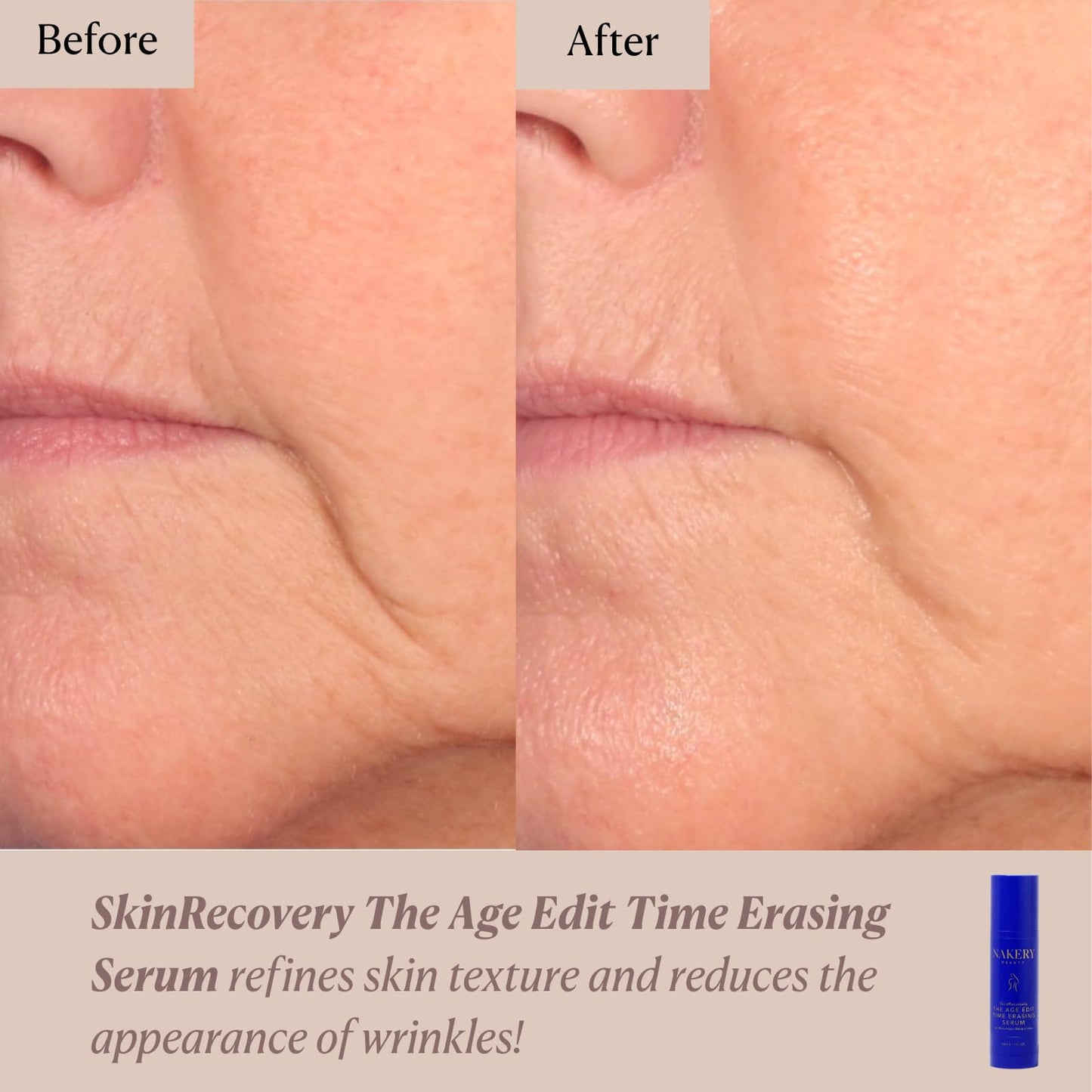 Nakery Beauty SkinRecovery The Age Edit Time Erasing Serum For Face, Anti Aging Exfoliating Serum With Multi Acid Blend And Magnesium, Helps Improve The Look Of Firmness Tone And Texture