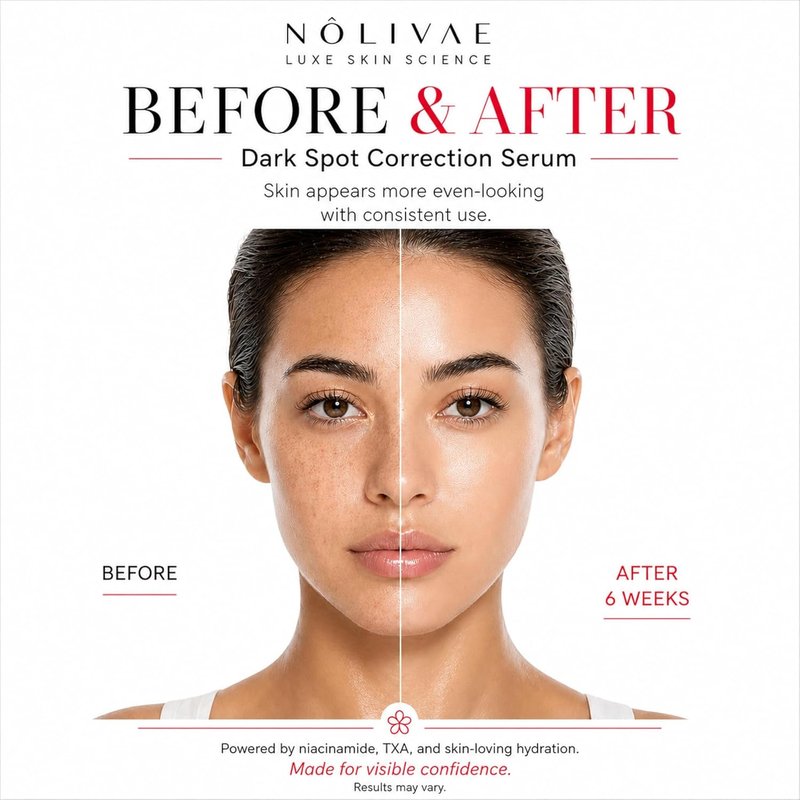 Niacinamide Dark Spot Care Serum - 10% Niacinamide, 4% TXA, 2% Alpha Arbutin | Lightweight Hydrating Formula for Even Skin Tone, 1 fl oz