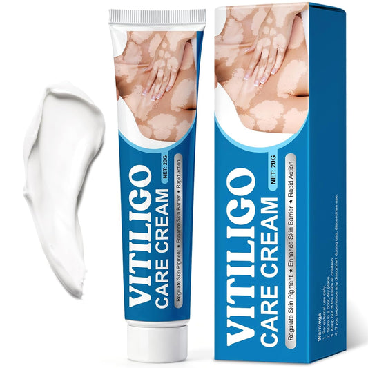 Vitiligo Treatment Cream - Natural Formula for Pigmentation & White Spots | 20g, Gentle for All Skin Types