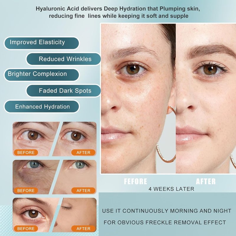 Vitamin C Serum - Anti-Aging Face Treatment with Hyaluronic Acid & Peptides | 1 fl oz, Dark Spot Corrector for Firming & Hydrating