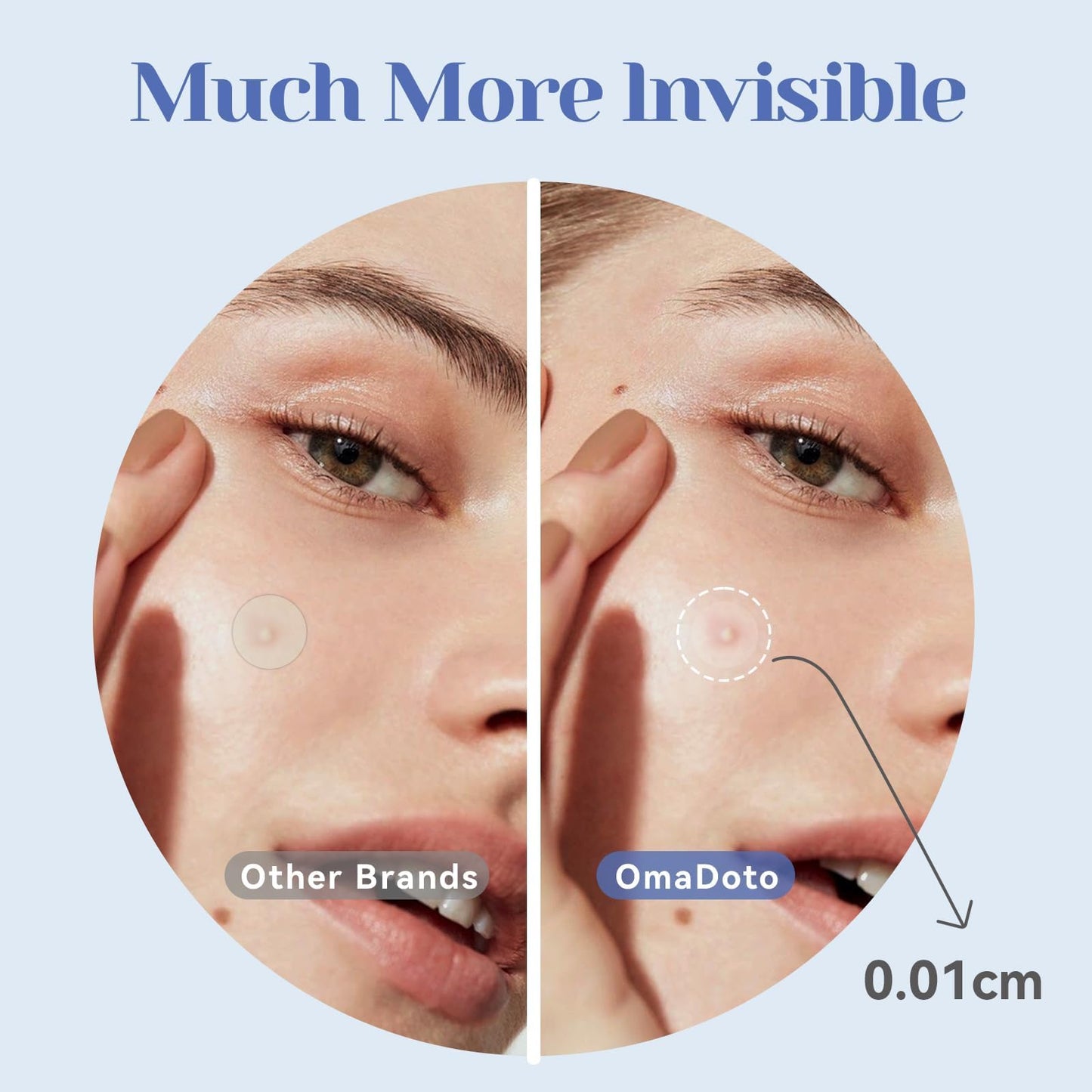 OMADOTO Invisible Pimple Patches for Face, Ultra-Thin Hydrocolloid Acne Patches, Covering Zits & Blemishes, Suitable Daytime Discreet Under Makeup, Zit Stickers, 12mm 72 Count