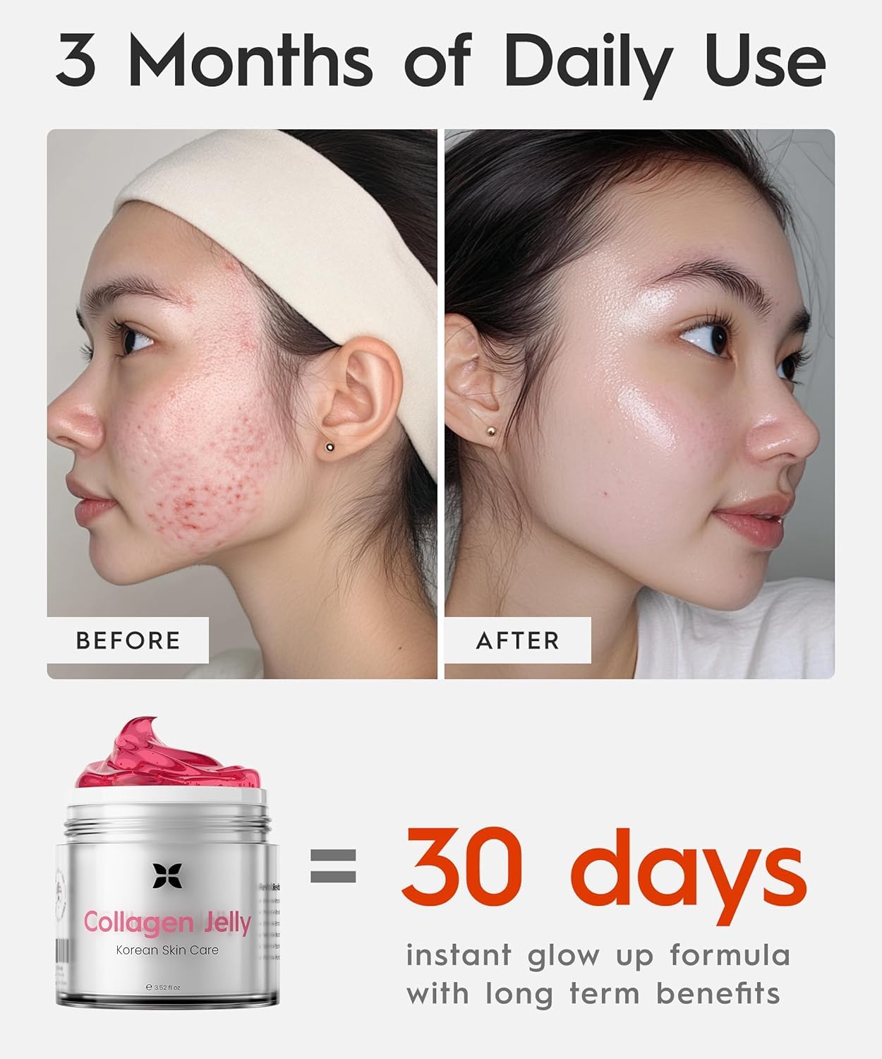 REVO Collagen Jelly – Korean Anti-Aging Plumping Formula with Hydrolyzed Collagen, Niacinamide, Hyaluronic Acid & Vitamin C – Skincare for Glass Glow Skin, Wrinkle Repair & Even Tone (1.76 Fl Oz)
