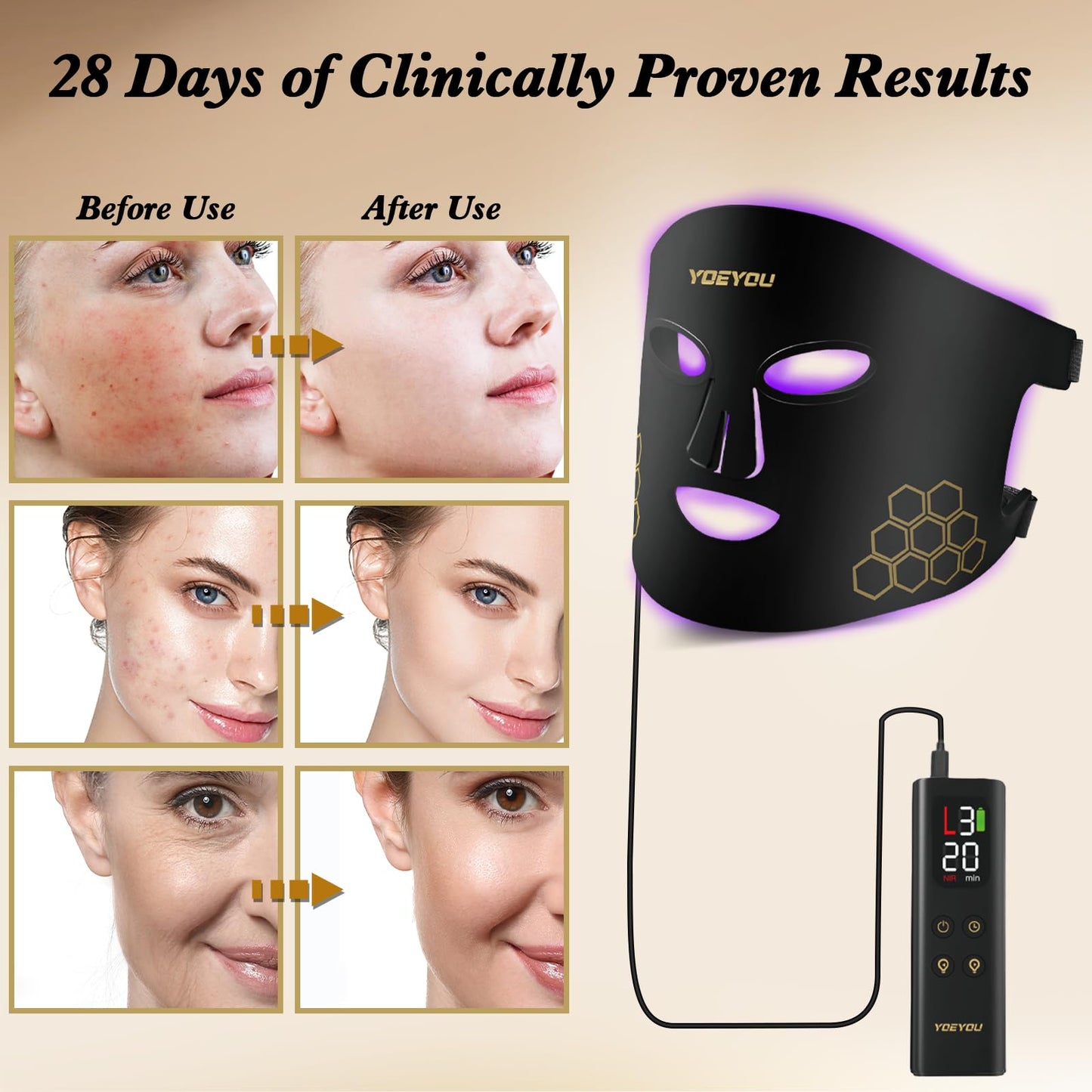YOEYOU Red Light Therapy for Face, 850nm Near Infrared LED Face Mask, 4 Light Modes, Portable Rechargeable Red Light Therapy Mask Skincare Device for Facial Rejuvenation