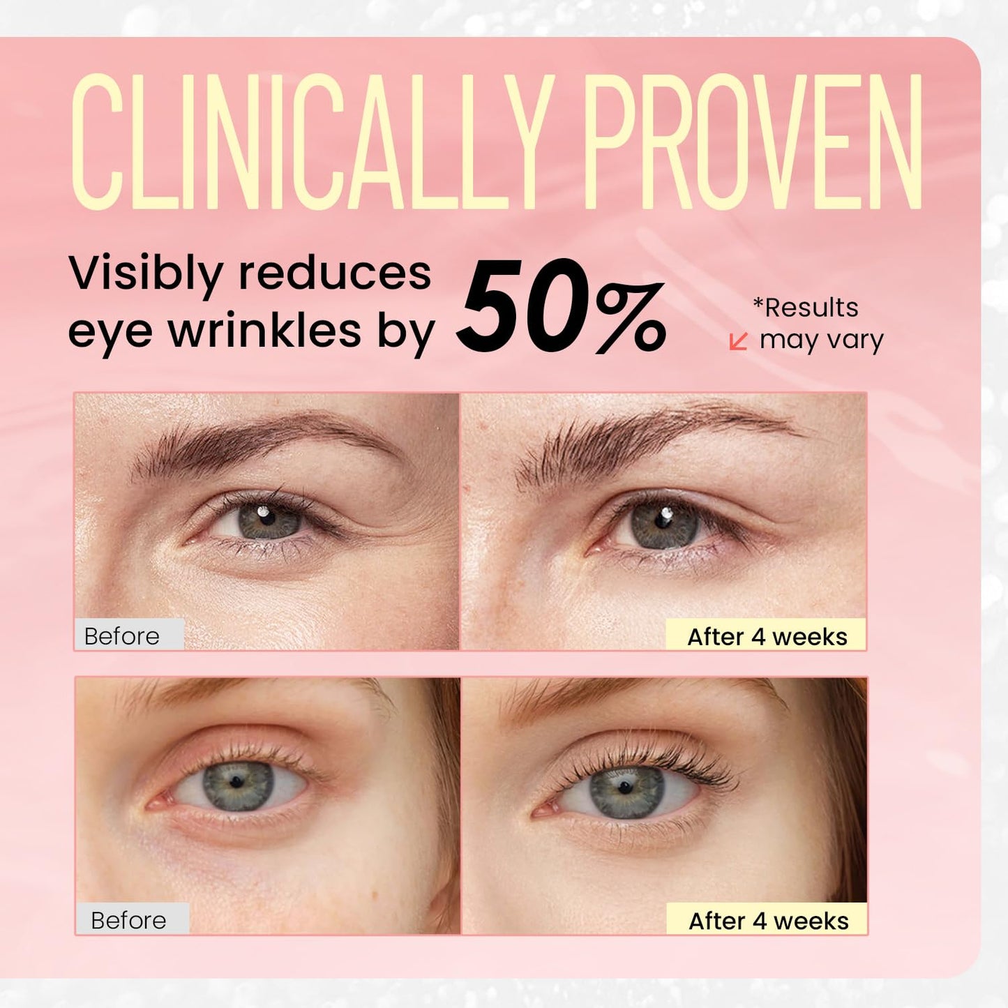 RONKIE Eye Cream for Dark Circles: Under Eye Cream with Retinol Caffeine - Reduces Under Eye Bags and Fine Lines