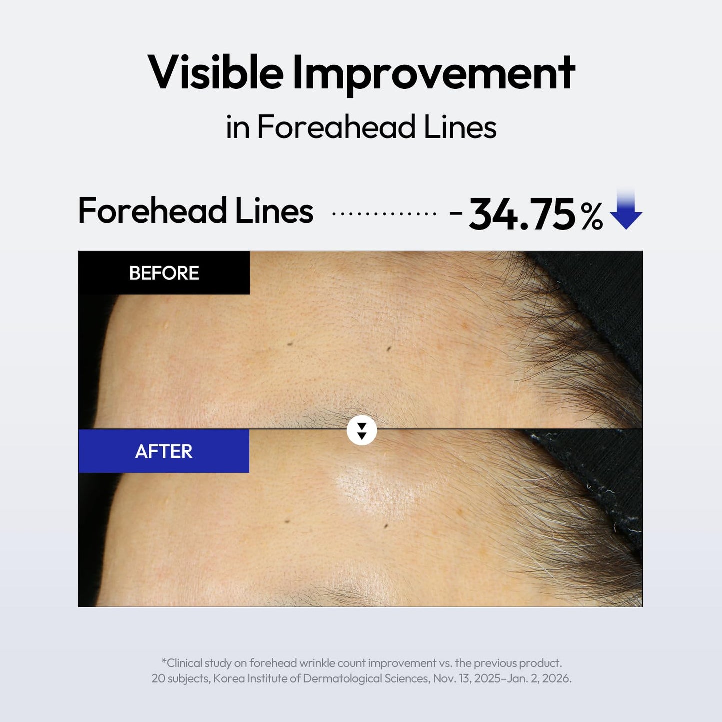 LAYERLAB 3X RH Serum 1.65%, Triple Retinoed Complex, 30ml, 1.01 fl.oz