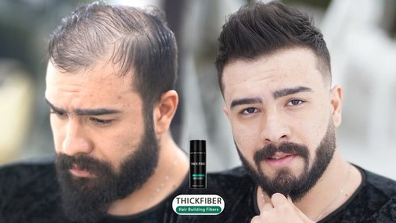 THICK FIBER Hair Fibers for Thinning Hair & Bald spots (BLACK) - 25g Bottle - Conceals Hair Loss in Seconds - Hair Powder for Women & Men