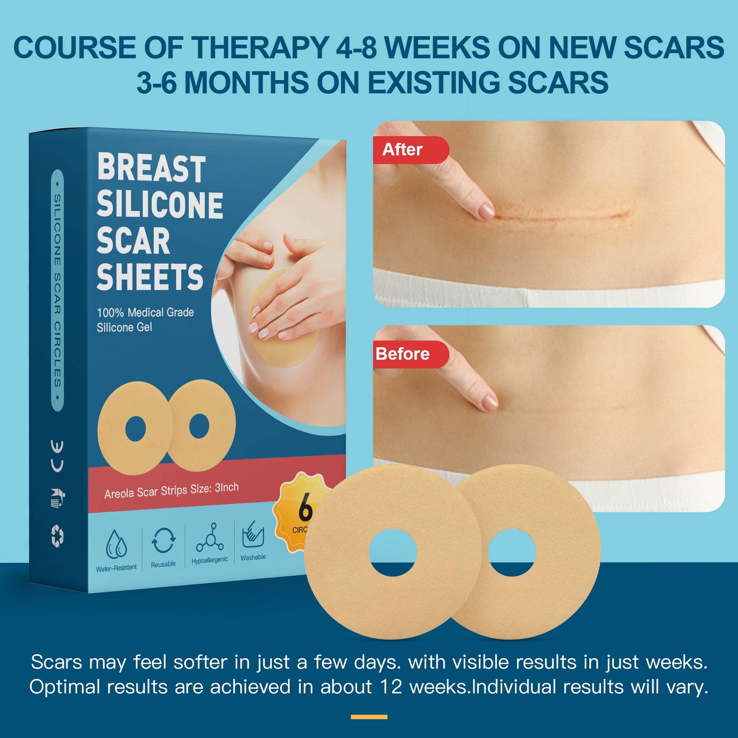Breast Silicone Scar Sheets, Silicone Scar Removal Sheets for Breast 6 Pack