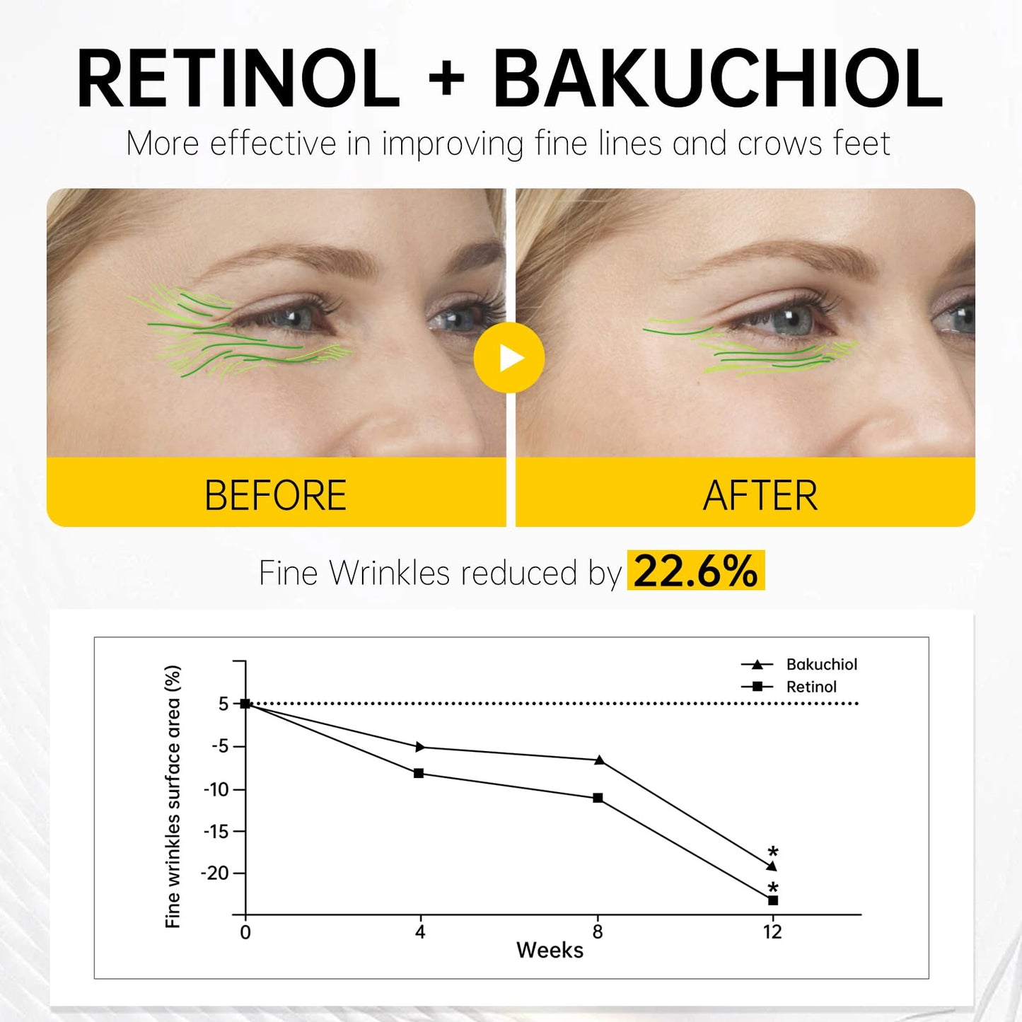 VGO Retinol Eye Cream, Anti-Aging Eye Cream for Dark Circles & Puffiness with 1% Retinol, 1% Bakuchiol & 6% Caffeine to Reduce Wrinkles, Fine Lines, De-puff and Eye Bags, 0.52 oz/15g, Made in USA