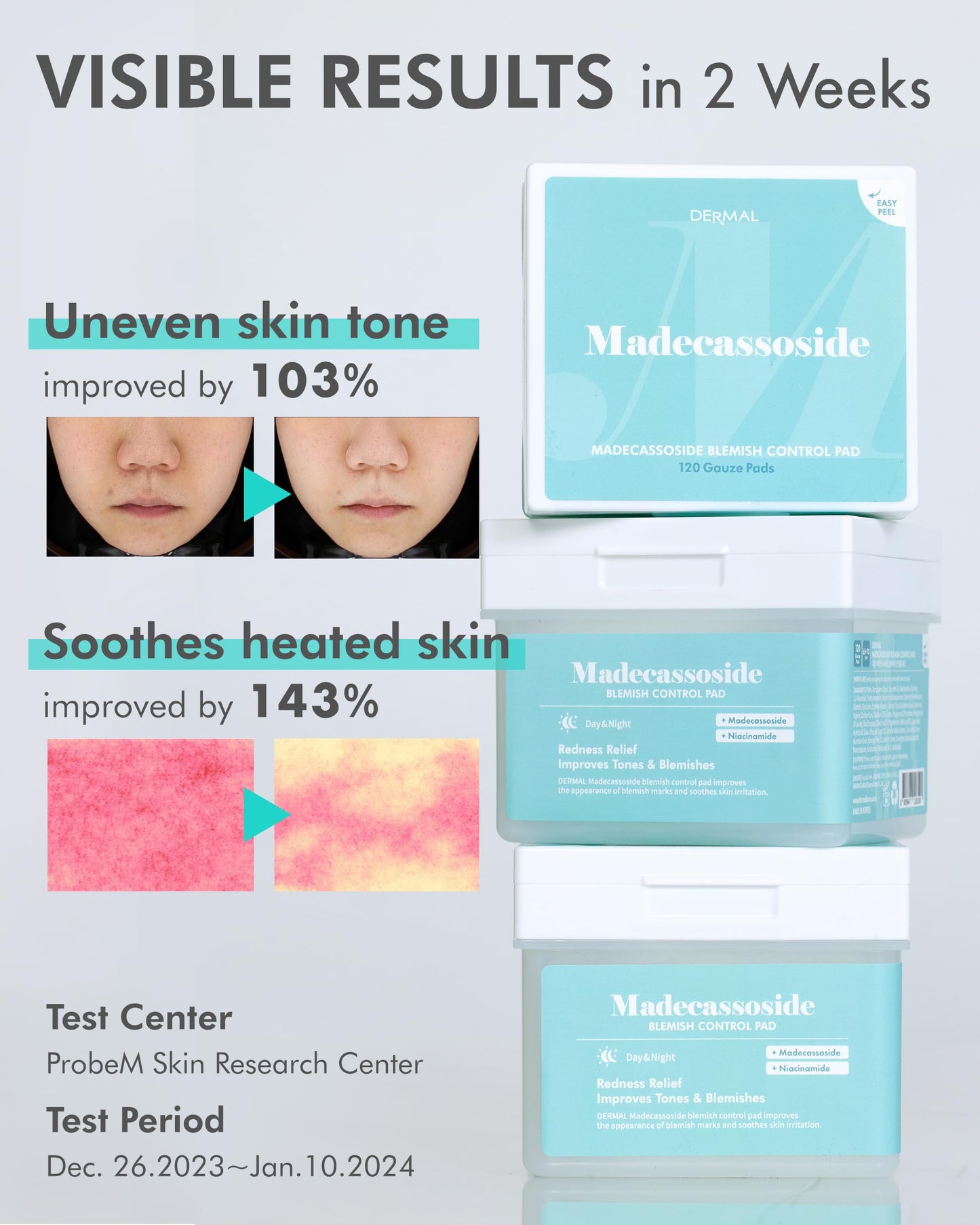 DERMAL Madecassoside Blemish Control Pad - Korean Toner Pad for Blemish & Tone Improvement with Centella Asiatica - Vegan Gauze Tencel Square Pads - Travel Kit 12 Pads, 3 Pack (Total 36 ea)