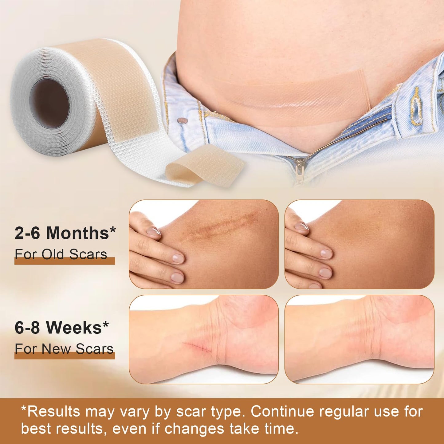 Silicone Scar Sheets for C-Section & Surgery - 3M Roll (1.6"x118") - Reusable & Hypoallergenic Scar Tape to Fade Scars from Acne, Burns, Keloid | Doctor Recommended
