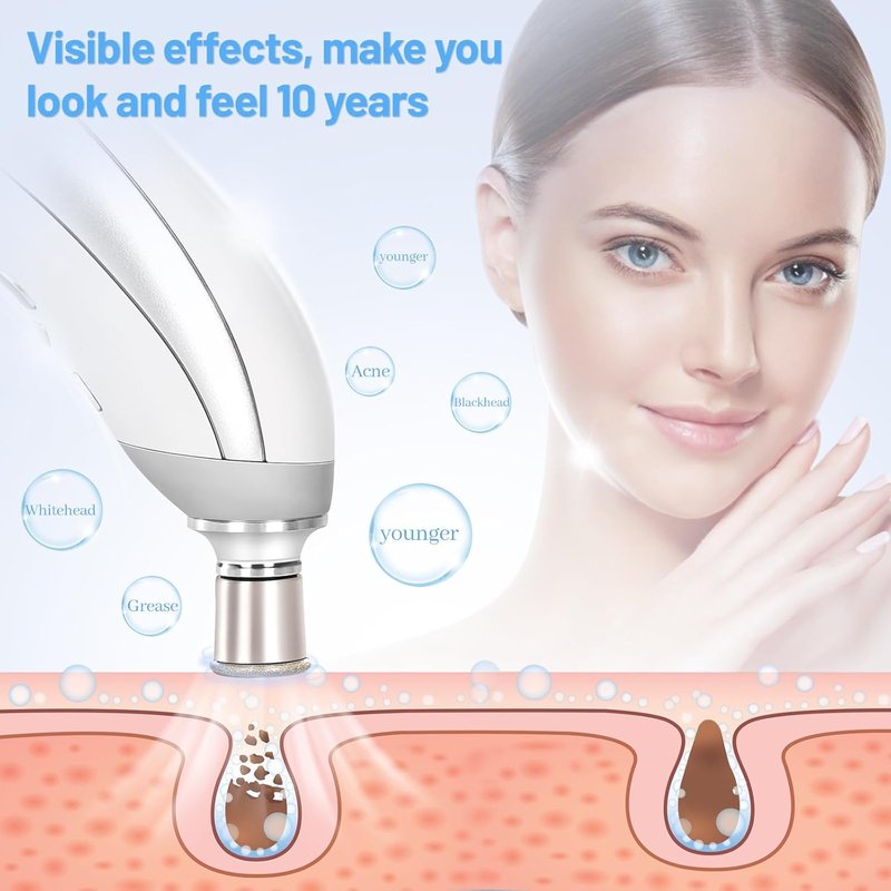 Diamond Microdermabrasion Machine - Portable USB Skin Exfoliation Device | Cordless Blackhead Remover for Women