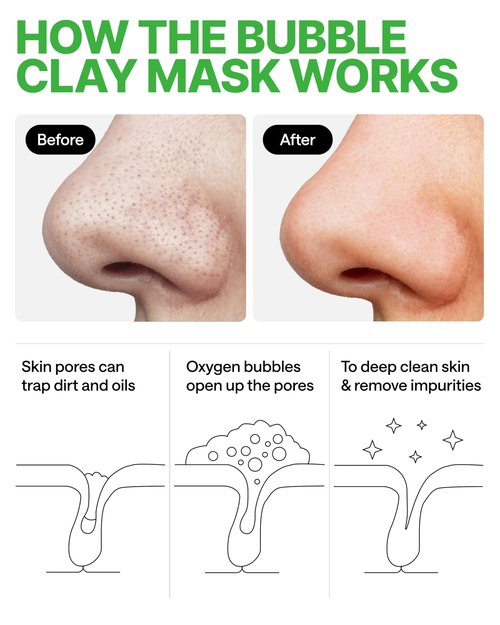 WONDER FAMILY Korean Carbonated Bubble Clay Mask for Face – Black Head Remover for Face – Deep Pore Cleansing Mask – Facial Blackhead Remover Mask – Pack 14 Korean Face Masks Skincare