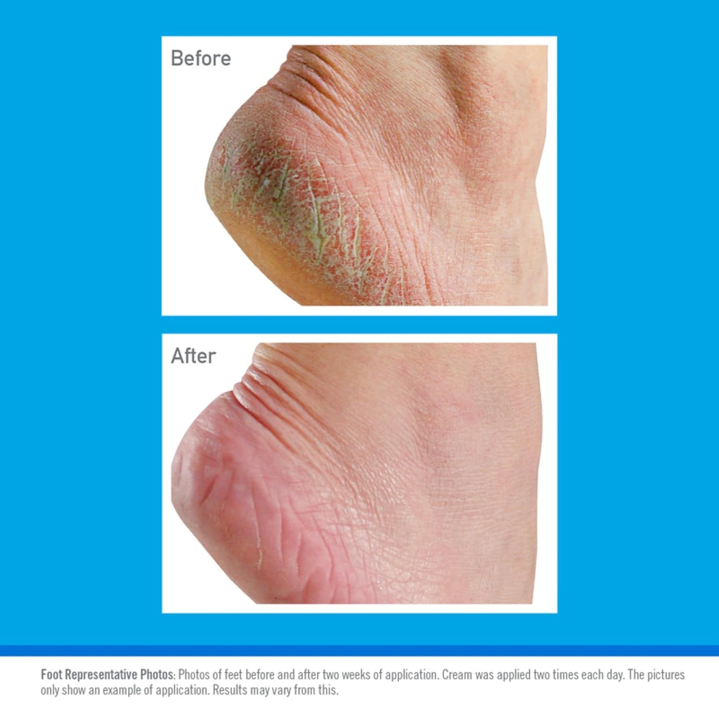 O’Keeffe’s Healthy Feet Cream Twin Pack - 91g Moisturizing Foot Care