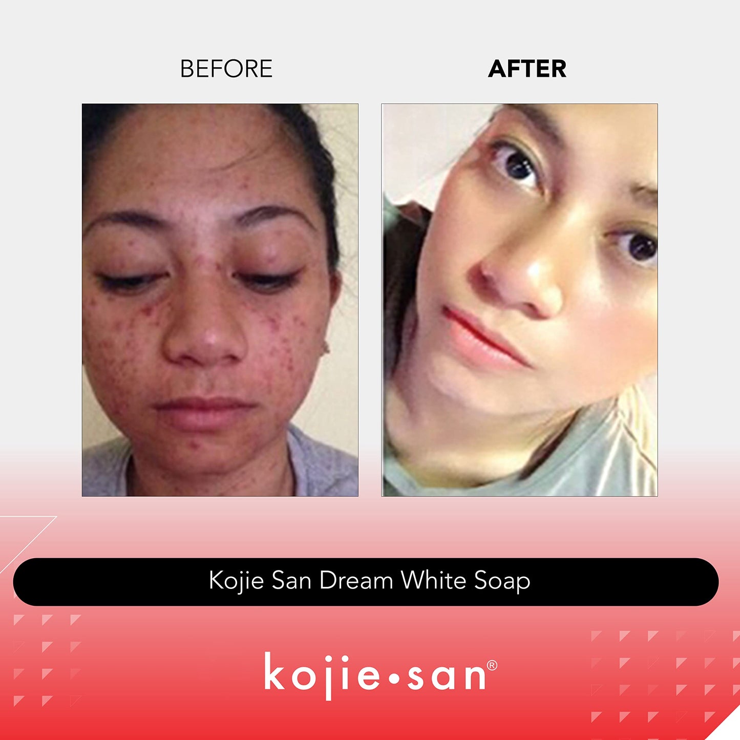 Skin Science Original Kojie San Dream White Soap-65g,2 Bars Per Pack - Guaranteed Authentic,2.29 Ounce (Pack of 2)