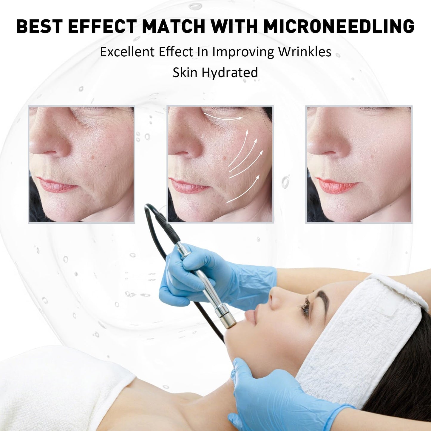 Hyaluronic Acid for Microneedling Concentrate Ampoules 5 Vials 0.35 Fl Oz