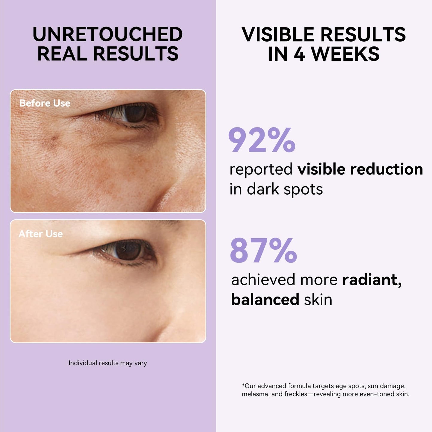 Dark Spot Remover for Face and Body - Dark Spot Corrector Serum for Sun Spots, Age Spots, Brown Spot，Freckles & Melasma - Skin Care Repair Evens Skin Tone for Women & Man Daily Use 1.69 FLoz