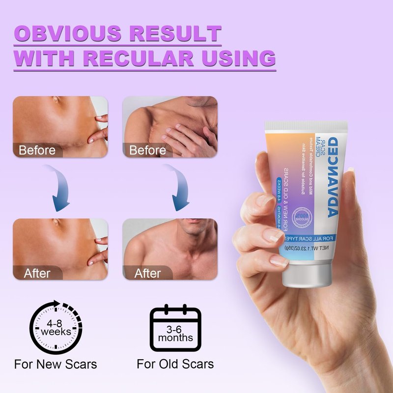 Silicone Scar Cream Gel - Advanced Treatment for Surgical Scars, Keloids, Acne & Stretch Marks | 1.23 Oz (35g)