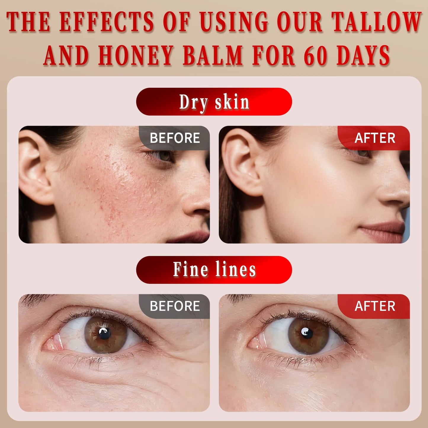 Balasoma Beef Tallow for Skin - Tallow and Honey Balm for Face Body - Contains Natural Plant Ingredients - Deep Moisturizing and Nourishing with Anti-aging Effects