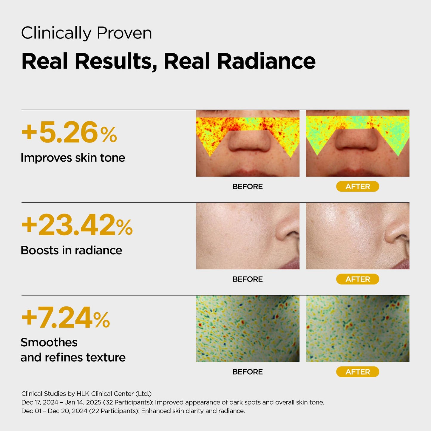 L-Glutathione Vitamin Boosting Toner infused with Niacinamide, Vitamin C, Glutathione & Tocopherol | Uneven & Dull Skin, Anti-Pigmentation Korean Skincare (10.14 fl oz / 300 ml)