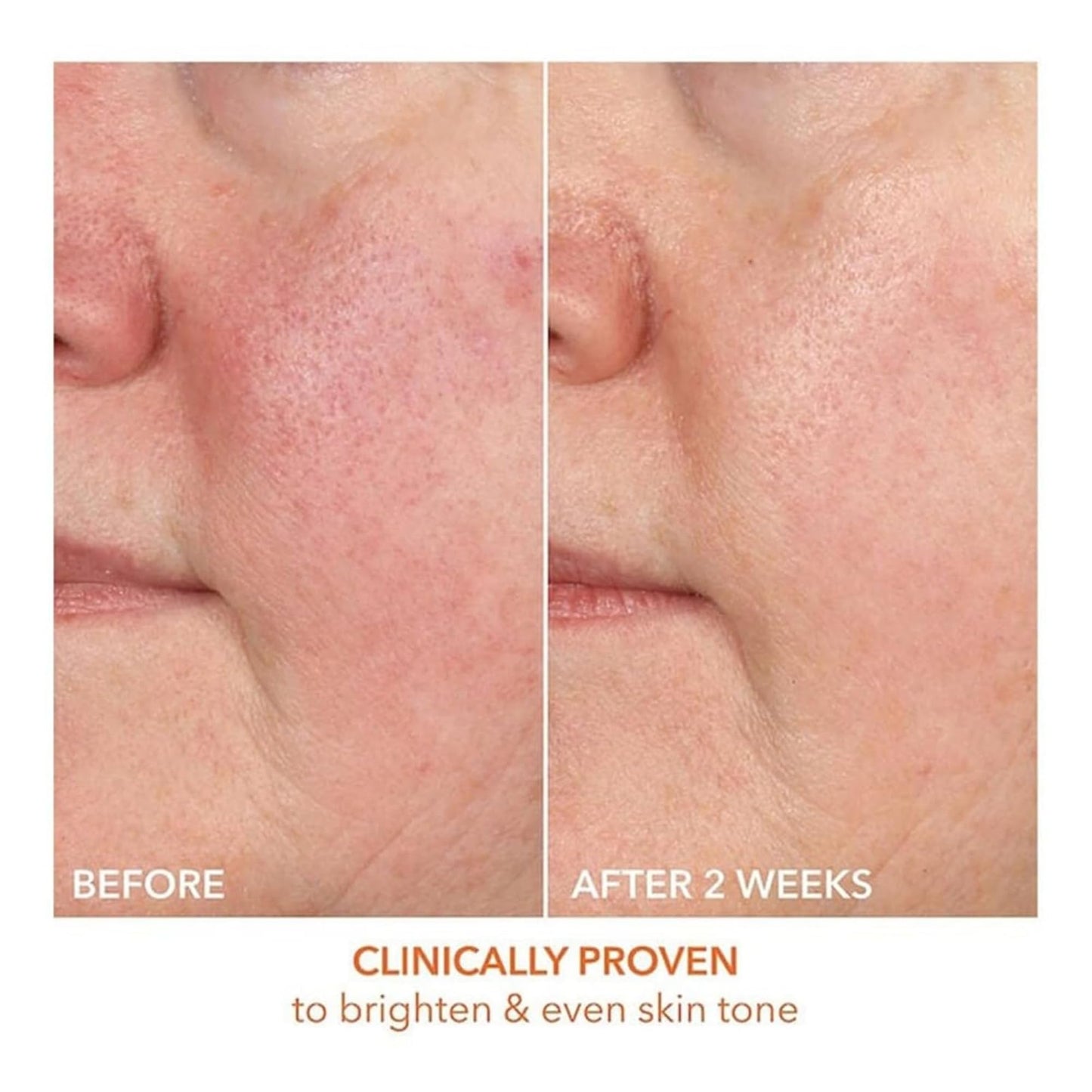 Dr Dennis Gross Vitamin C Serum