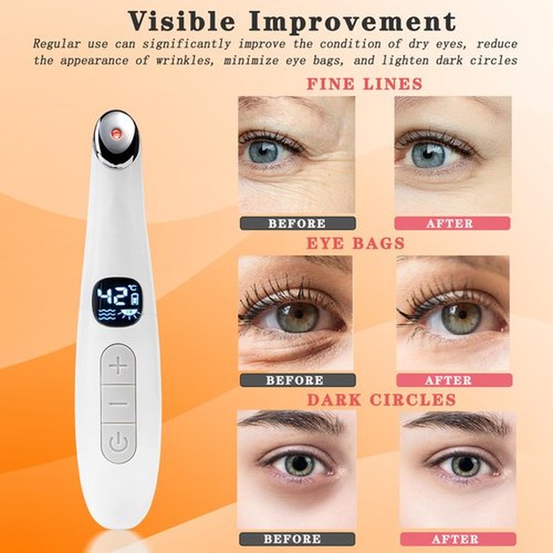 Vowleike Eye Lift Wand, 3 in 1 Vibrating 98°F to 113°F LCD Display Screen Eye Massager for Dry Eyes, Dark Circles and Puffiness, Fine Lines and Wrinkles, Cream White