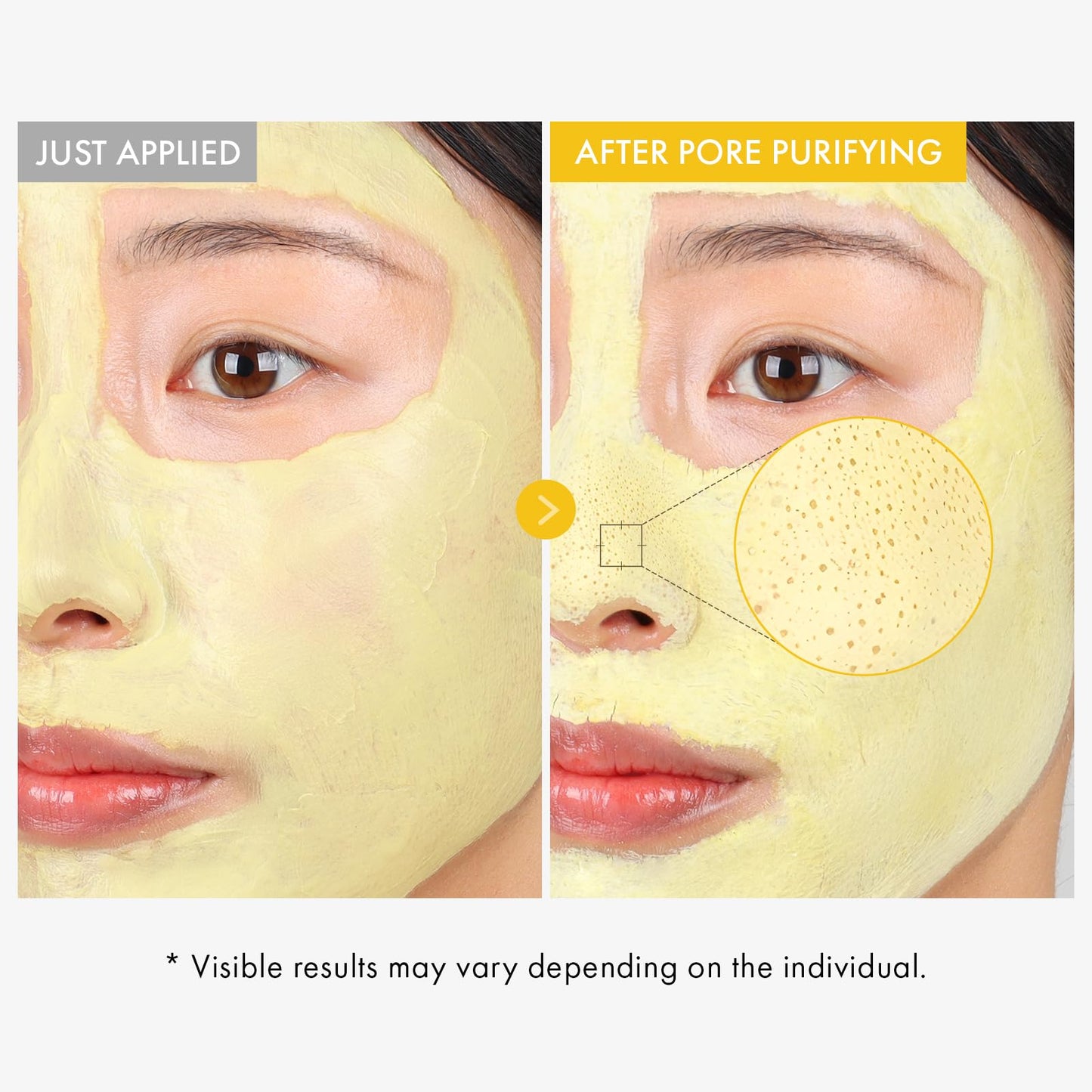 TOSOWOONG Kojic Acid Turmeric Mud Mask, Dark Spot & Blackhead Cleanser with Vitamin C, Niacinamide, Arbutin, Pore Cleaner, Clear Skin, Cooling Quick Dry Formula Face mask, Korean Skincare,100g/3.52oz.