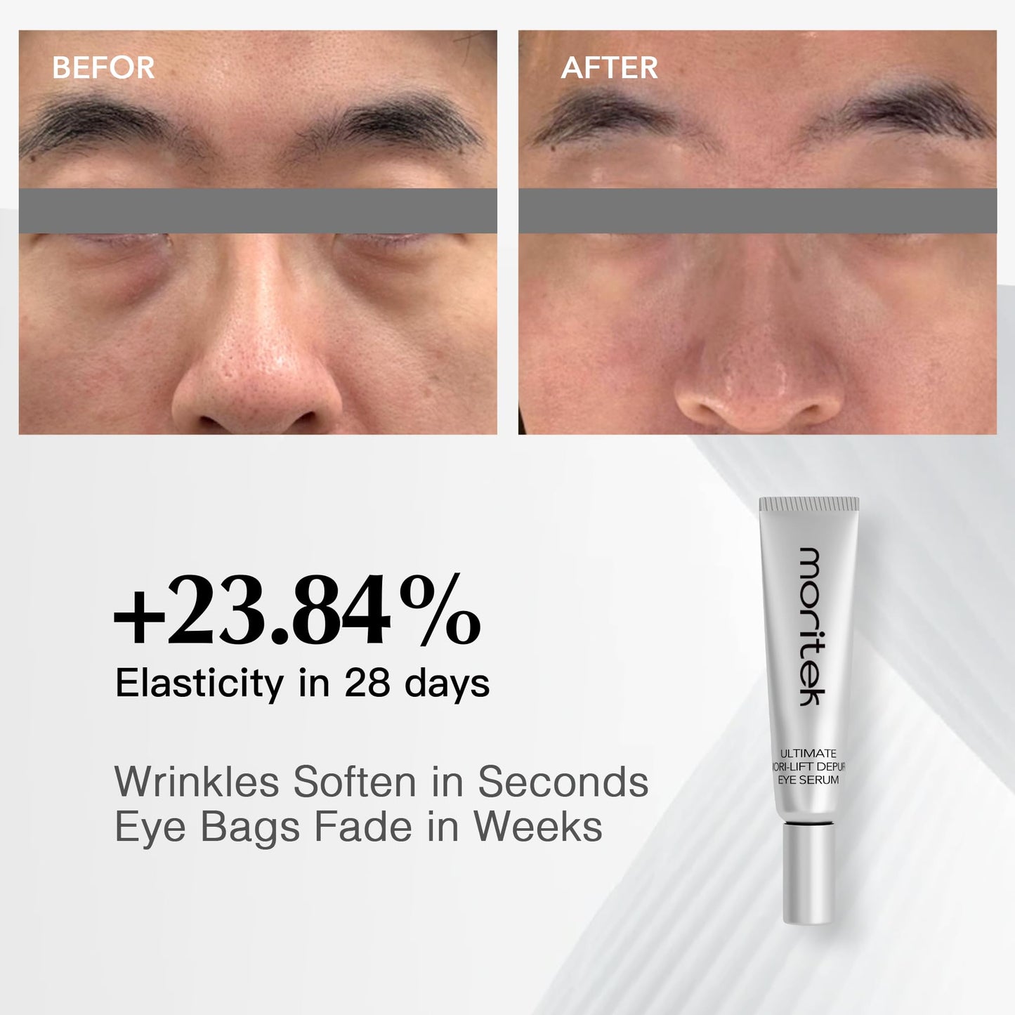 MORlTEK Deep Anti-Aging Wrinkle Remover & Eye Serum Visibly Reduces Under-Eye Bags, Puffiness, Dark Circles, Wrinkles, Fine Lines & Crow's Feet Instantly