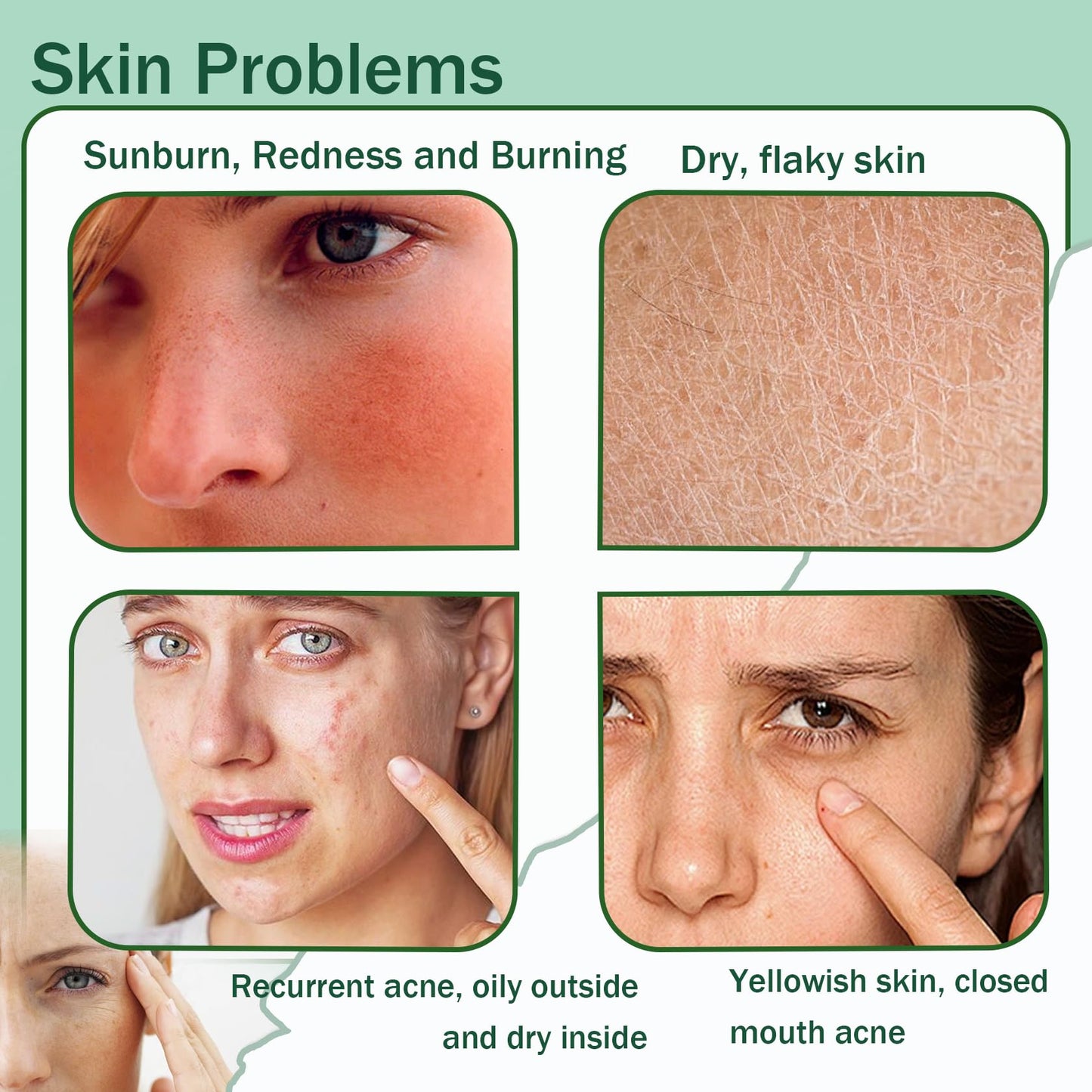 JunKuJK Purity Aloe Vera Gel - Hydrating Aloe Vera Gel for Face and Skin,No Sticky Moisturizing Aloe Gel D