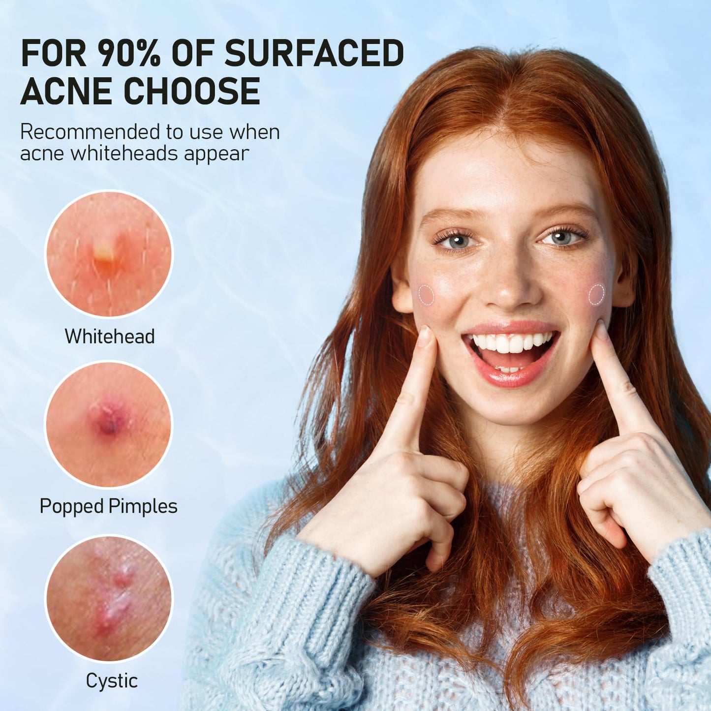 ANGTICS Pimple Patches for Face, 2 Sizes 192 Counts Acne Patches, Hydrocolloid Patches Zit Patches for Skin Care, Blemish Patches Invisible Acne Spot Treatment with Salicylic Acid, Tea Tree Oil