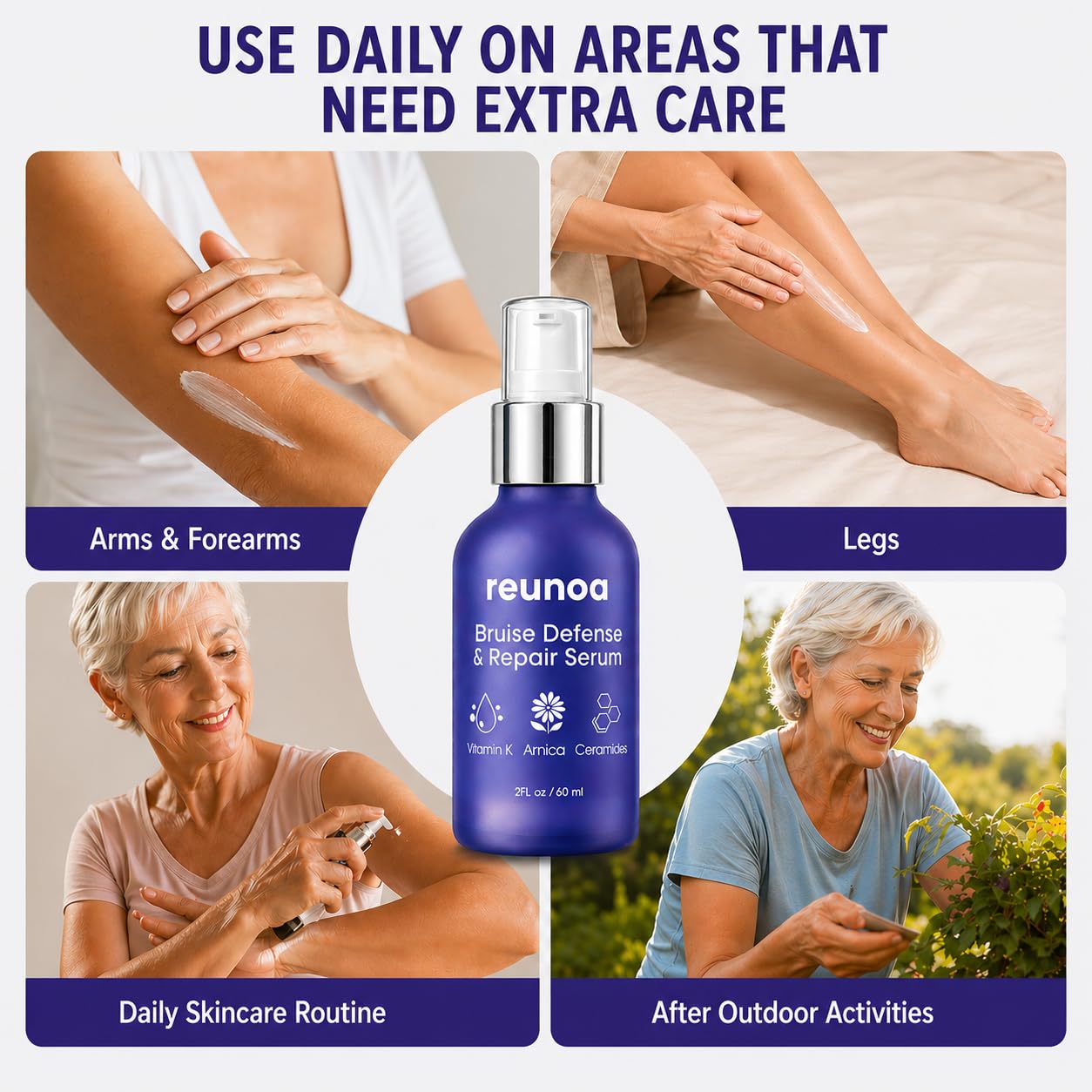Reunoa Bruise Defense Repair Serum, Reunoa Cream Korvel Serum for Skin with Arnica, Vitamin K, Ceramides, Deep Hydrators, Redwuce Drynaess, 60ml