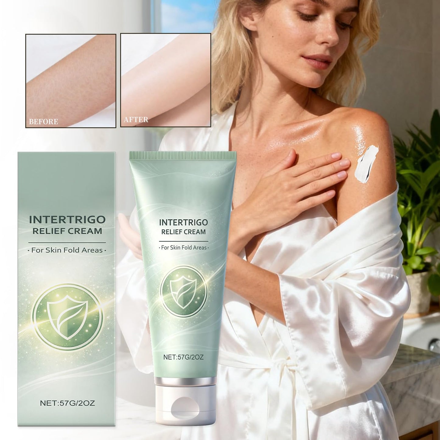 Intertrigo Treatment Cream – Zinc Oxide & Undecylenic Acid, 2 Oz