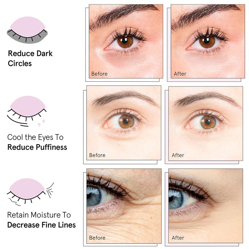 Under Eye Mask Variety Pack - 18 Pairs of Gel Patches for Dark Circles | 6 Colors, Vegan Gift Set for Women